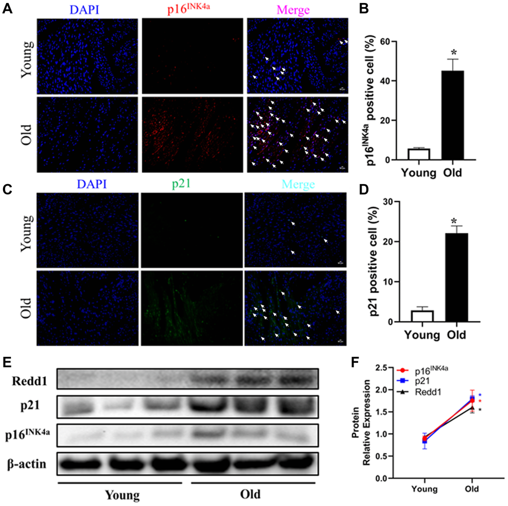 Cardiac Redd1 expression increases with advancing age. (A, B) Representative photomicrographs and quantitative analysis of myocardial p16INK4a immunofluorescent staining in young group mice (3~4 months old) and old group mice (24 months old) (n = 6 per group). (C, D) Representative photomicrographs of myocardial p21 immunofluorescent staining and quantitative expression analysis in young group mice and old group mice (n = 6 per group). (E, F) Western blotting detection and quantification of Redd1, p16INK4a, and p21 protein expression in the heart of young group mice and old group mice (n = 6–8 per group). Data are mean ± SEM. *p 