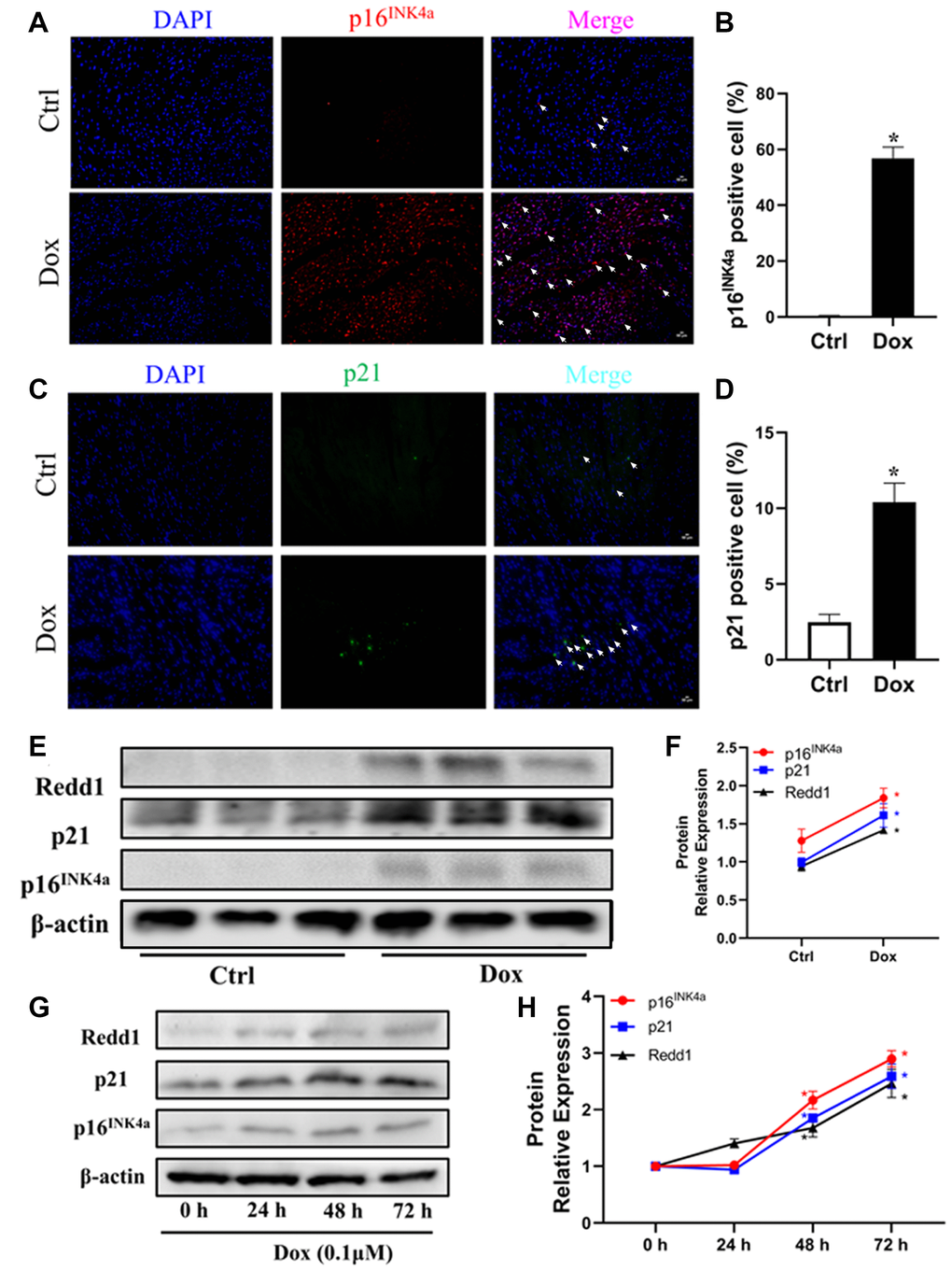 Dox exposure upregulates Redd1 expression in both cardiac tissue and cultured cardiomyocytes. (A, B) Representative photomicrographs and quantitative analysis of cardiac p16INK4a immunofluorescent staining in control and Dox-treated mice (n = 6 per group). (C, D) Representative photomicrographs and quantitative analysis of cardiac p21 immunofluorescent staining in control and Dox-treated mice (n = 6 per group). (E, F) Western blotting detection and quantification of Redd1, p16INK4a, and p21 expression in cardiac tissue from control and Dox-treated mice (n = 6–8 per group). (G, H) Time-course expression and quantification analysis of Redd1, p16INK4a, and p21 protein levels in cultured H9c2 cardiomyocytes treated with Dox (0.1 μM) (n = 3 samples per group). Data are mean ± SEM. *p 