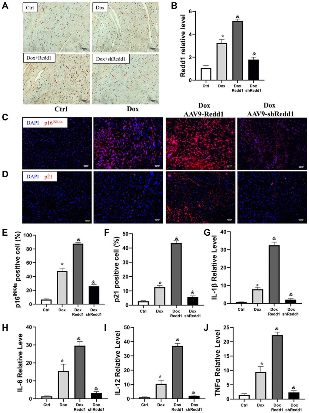 Redd1 expression enhances Dox-induced cardiac senescence in vivo. (A, B) Representative images and corresponding quantitative expression analysis of Redd1 immunostaining in mouse heart tissues (n = 6 mice per group). (C, D) Immunofluorescence analysis of the effect of Redd1 overexpression and knockdown on p16INK4a and p21 expression in cardiac samples from Dox-treated mice. (E, F) Quantification of p16INK4a and p21 expression data (n = 6–8 per group). (G–J) Effect of Redd1 overexpression and knockdown on IL-1β, IL-6, IL-12, and TNFα mRNA in cardiac tissue from Dox-treated mice (n = 6–8 per group). Data are mean ± SEM. *p &p 