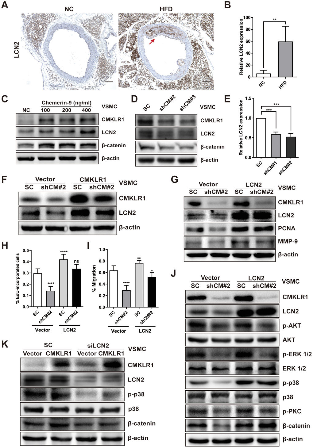 LCN2 is essential for the inhibition of VSMCs proliferation by CMKLR1 depletion. (A) IHC analysis of Lipocalin-2 (LCN2) expression in aorta tissues of mice fed with normal and HFD. Scale bar = 100 μm. Red arrows indicate plaques. (B) Chemerin expression score analysis data presented as the means ± SDs. **, pC) Western blots showing LCN2, MMP-9, and β-catenin expression in cells treated with chemerin-9 (48 h) for different durations. (D) Western blot showing LCN2, MMP-9, and β-catenin expression, with or without CMKLR1 knockdown. (E) mRNA expression of LCN2, with or without CMKLR1 depletion, as determined by quantitative real-time PCR. (F) Western blots showing CMKLR1 and LCN2 expression following the application of plasmids encoding CMKLR1 to overexpress CMKLR1 expression in VSMCs with or without CMKLR1 depletion. (G) Western blots showing CMKLR1, LCN2, PCNA and MMP-9 expression following the application of plasmids encoding LCN2 to overexpress LCN2 expression in VSMCs with or without CMKLR1 depletion. (H) Analysis of the percentage EdU-incorporated cells. ****, pI) Cell migration as determined by wound healing assay. Percentage of cell migration data presented as means ± SDs. ****, pppJ) Western blots showing CMKLR1, LCN2, p-AKT, AKT, p-ERK 1/2, ERK 1/2, p-p38, p38, p-PKC and β-catenin expression following the application of plasmids encoding LCN2 to overexpress LCN2 expression in VSMCs with or without CMKLR1 depletion. (K) Western blots showing CMKLR1, LCN2, p-p38, p38 and β-catenin expression following the transfection of small interfering RNA (siRNA) targeting LCN2 (siLCN2) into VSMCs with or without CMKLR1 overexpression.