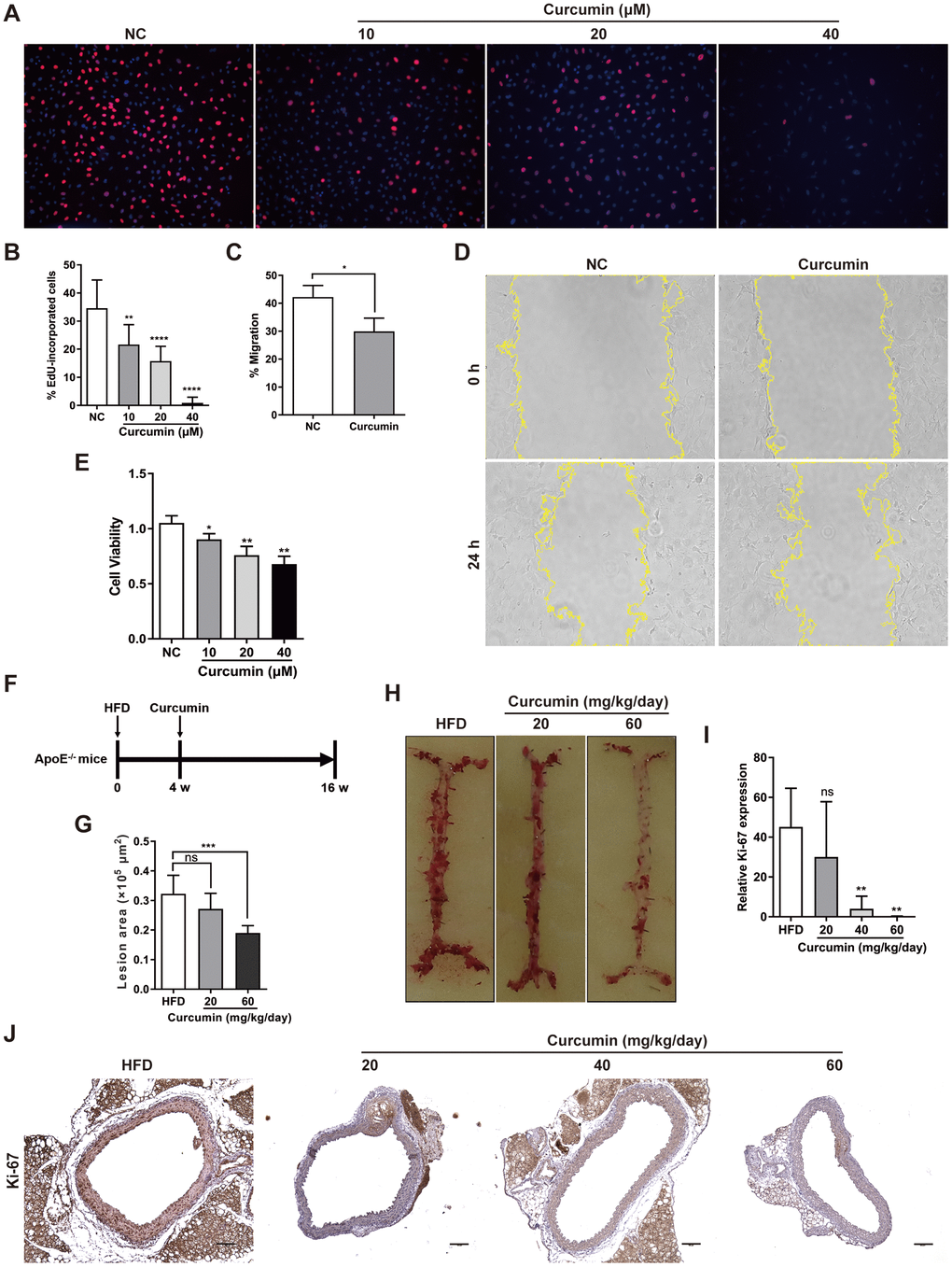 Curcumin inhibits AS plaque by decrease VSMCs proliferation and migration. (A, B) Analysis of percentage EdU-incorporated cells following curcumin treatment (48 h) for different durations. **, ppC, D) Cell migration with or without curcumin treatment (20 μM, 24 h) as determined by wound healing assay. Percentage cell migration data are presented as means ± SDs. *, pE) CCK-8 assessment of cell proliferation following treatment with curcumin (48 h) for different durations. *, ppF) Schematic illustration of the establishment of a HFD ApoE-/- mice model combined with curcumin treatment. HFD group, n = 8; curcumin (20 mg/kg/day), n = 8; curcumin (40 mg/kg/day), n = 8; curcumin (60 mg/kg/day), n = 8. (G, H) The lesion areas in aorta tissues of HFD ApoE-/- mice with or without curcumin treatment. n.s., no significant; ***, pI, J) IHC analysis of Ki-67 expression in aorta tissues of HFD ApoE-/- mice with or without curcumin treatment. Scale bar = 100 μm. Red arrows indicate plaques. Ki-67 expression score analysis data are presented as means ± SDs. n.s., no significant; **, p