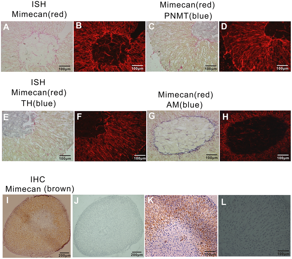 Localization of mimecan expression in mouse adrenal glands using in situ hybridization and immunohistochemistry. (A) Positive staining (red) of sections of adrenal glands hybridized with DIG-labeled mimecan antisense probes primarily appeared in the adrenal cortex and some of the medullary mesenchyme (image obtained under visible light at 10× magnification). (B) The field shown is the same as (A) under fluorescent light. (C) Sections of adrenal glands hybridized with fluorescein-labeled mimecan and DIG-labeled PNMT antisense probes, confirming mimecan expression (red) primarily within the adrenal cortex and PNMT (phenylethanolamine-N methyl transferase; blue) expression in the medulla; no co-expression was observed (image obtained under visible light at 10× magnification). (D) The field shown is the same as (C) under fluorescent light. (E) Sections of adrenal glands hybridized with fluorescein-labeled mimecan and DIG-labeled TH antisense probes, confirming mimecan expression (red) primarily within the adrenal cortex, while TH (blue) was found in the medulla; no co-expression was observed (image obtained under visible light at 10× magnification). (F) The field shown is the same as (E) under fluorescent light. (G) Sections of adrenal glands hybridized with fluorescein-labeled mimecan and DIG-labeled ADREAM antisense probes, confirming mimecan expression (red) primarily within the adrenal cortex. Mimecan and ADREAM co-expression was observed in the medulla (image obtained under visible light). (H) The field shown is the same as (G) under fluorescent light. (I) Sections of formalin-fixed, paraffin-embedded adrenal glands immunostained with rabbit anti-human mimecan antibody and anti-rabbit IgG antibody. Positive (brown) staining was found primarily in the adrenal cortex. (J) Negative control of (I) with pre-immune rabbit serum used in lieu of mimecan antibody. (K–L) Higher magnifications of (I, J).