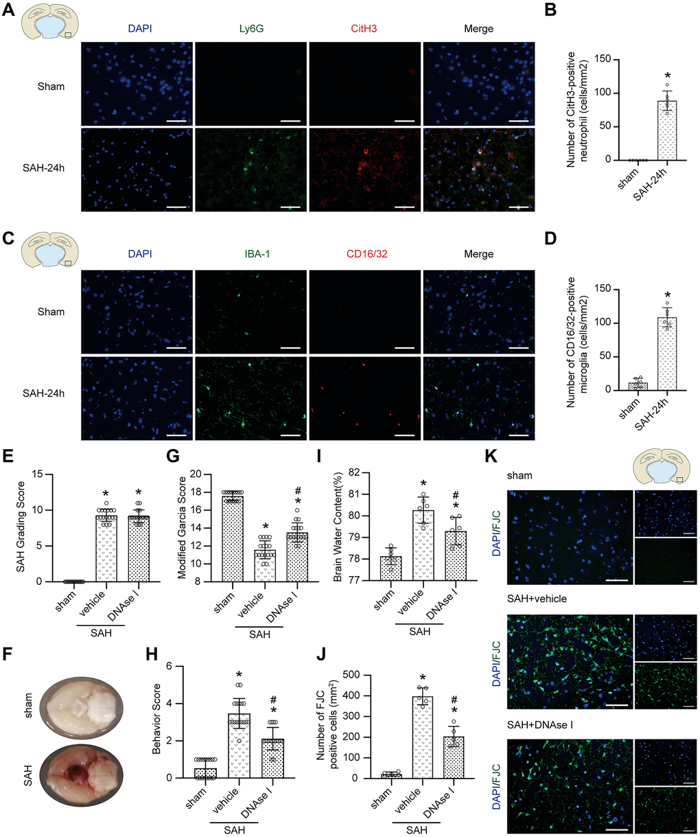 The effect of the formation of NETs after SAH. (A) Representative photographs of immunofluorescence staining showing NETs (marked with CitH3 (red)) in neutrophil (marked with Ly6G (green)) in sham group and SAH 24 h group. (B) Quantitative analysis of CitH3 positive neutrophils. n = 5/group (C) Representative photographs of immunofluorescence staining showing pro-inflammatory subtype (marked with CD16/32 (red)) microglia (marked with IBA-1 (green)) in sham group and SAH 24 h group. (D) Quantitative analysis of CD16/32 positive microglia. n = 5/group. Scale bar = 50 μm. *P E) The quantification of SAH grade. n = 17/group. (F) Typical brains without or with SAH. (G) Quantification of Modified Garcia Score at 24 h after SAH. n = 17/group. (H) Quantification of Behavior Score at 24 h after SAH. n = 17/group. (I) Quantification of brain water content. n = 6/group. (J) Quantitative analysis of FJC staining. n = 5/group. (K) Representative photograph showed the FJC positive cell (green) in different groups. Scale bar = 50 μm. *P #P 