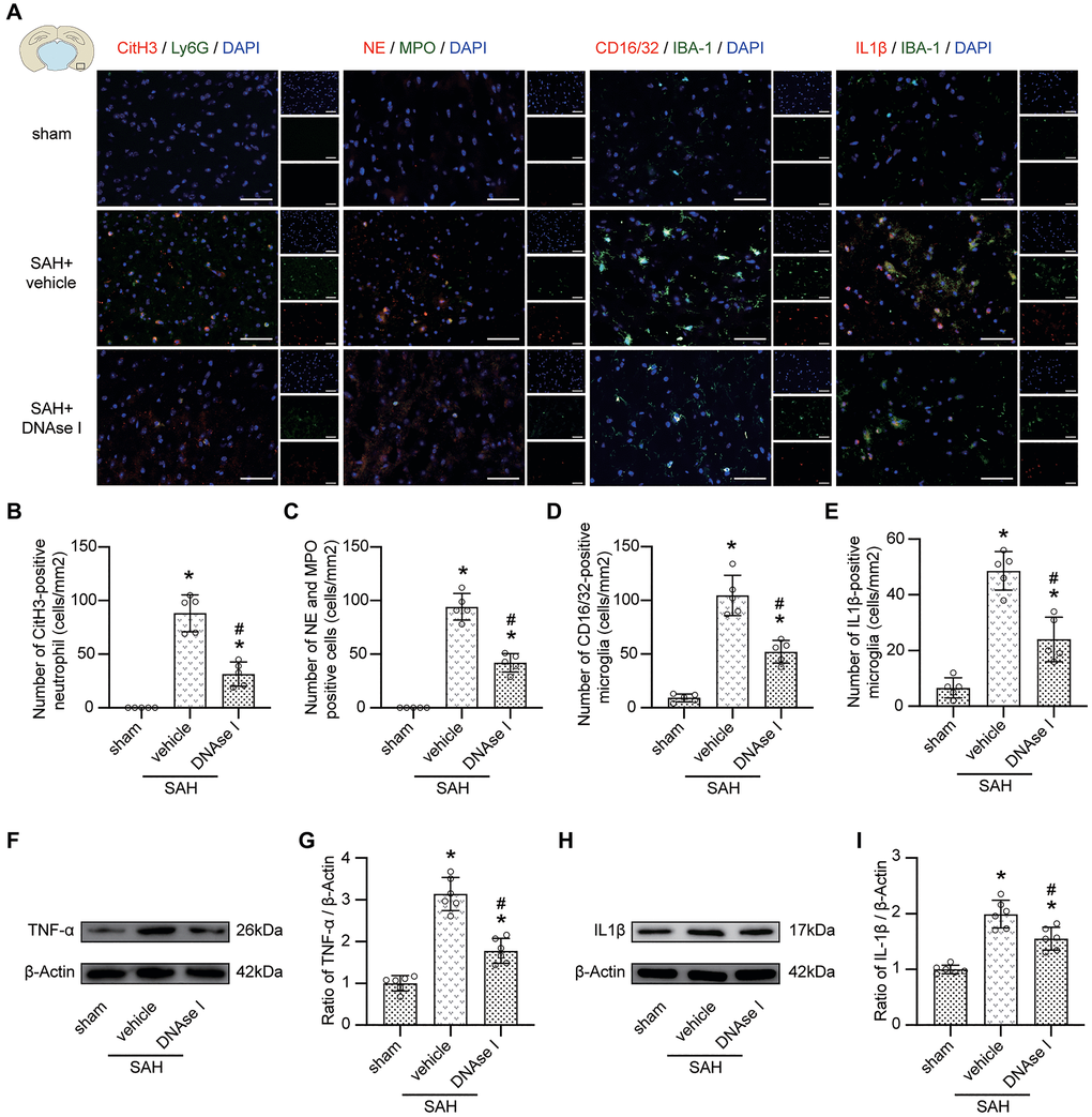 Inhibiting the formation of NETs prevents pro-inflammatory subtype transition of microglia. (A) Representative photograph showed the co-localization of CitH3 positive cell (red) with Ly6G (green), NE positive cell (red) with MPO (green), CD16/32 positive cell (red) with IBA-1 (green), IL1β positive cell (red) with IBA-1 (green), in different groups. (B) Quantitative analysis of CitH3 positive neutrophil in different groups. n = 5/group. (C) Quantitative analysis of NE and MPO positive cells in different groups. n = 5/group. (D) Quantitative analysis of CD16/32 positive microglia in different groups. n = 5/group. (E) Quantitative analysis of IL1β positive microglia in different groups. n = 5/group. (F) Representative western blotting images of TNF-α expression in cortex in different groups. (G) Quantitative analysis of TNF-α expression in cortex in different groups. n = 6/group. (H) Representative western blotting images of IL1β expression in cortex in different groups. (I) Quantitative analysis of IL1β expression in cortex in different groups. n = 6/group. Scale bar = 50 μm. *P #P 