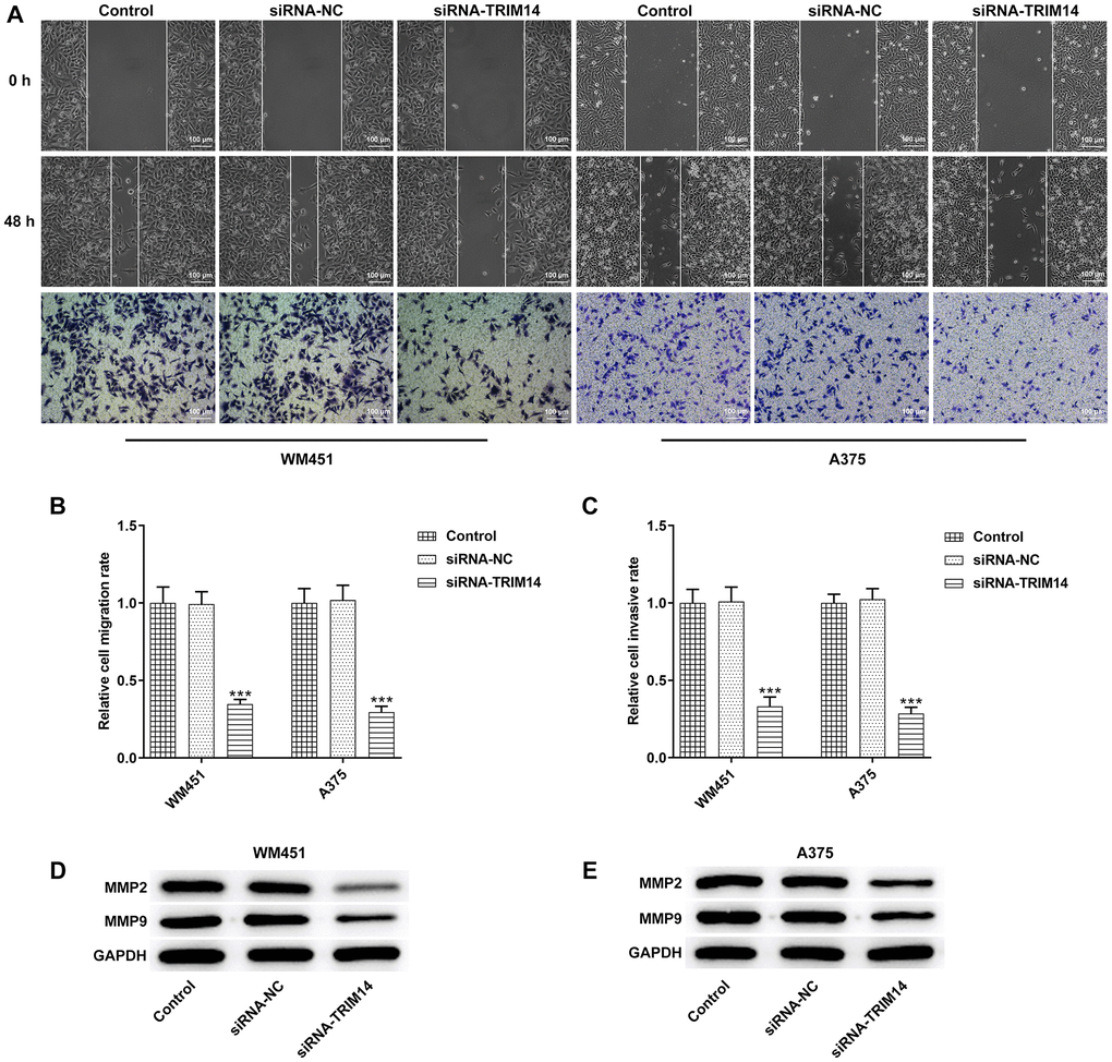 TRIM14 knockdown suppressed melanoma cell migration and invasion. After transfection in both WM451 and A375 cells, wound-healing assay and Transwell assay were applied to determine cell migration and invasion abilities, respectively (A–C). The protein expression of MMP2 and MMP9 in different groups of WM451 and A375 cells were measured using western blot (D–E). Magnification ×100. ***p 