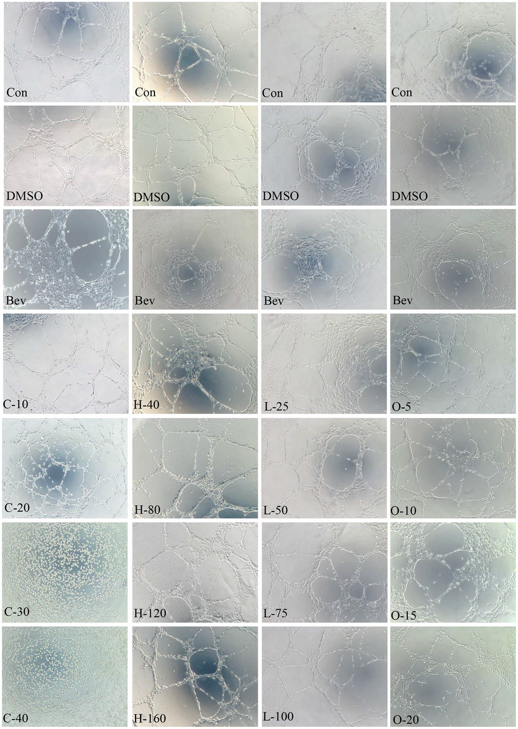 HRECs tube formation. Effects of cyclamic acid, hyodeoxycholic acid, L-tryptophanamide, and O-phosphorylethanolamine on the tubule formation of HRECs after treatment of 6h.