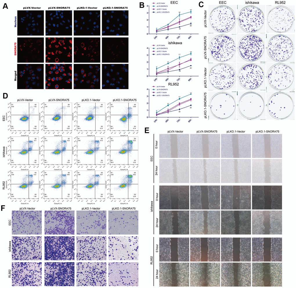 SNORA75 promotes the proliferation, migration and invasion of endometrial epithelial cells. (A) The expression of SNORA75 in EEC cells was detected by in situ hybridization. (B) CCK-8 was used to detect the effect of SNORA75 on the proliferation of EEC, Ishikawa and RL952 cells. (C) The colony formation assay was used to detect the effect of SNORA75 on the proliferation of EEC, Ishikawa and RL952 cells. (D) The apoptosis of EEC, Ishikawa and RL952 cells was detected by flow cytometry. (E) The effect of SNORA75 on the migration of EEC, Ishikawa and RL952 cells was detected by the cell scratch assay. (F) Transwell assays were used to detect the invasion of EEC, Ishikawa and rl952 cells. "##" indicates that, compared with the pLKO.1-vector group, P **" indicates that, compared with the pLVX-vector group, P 