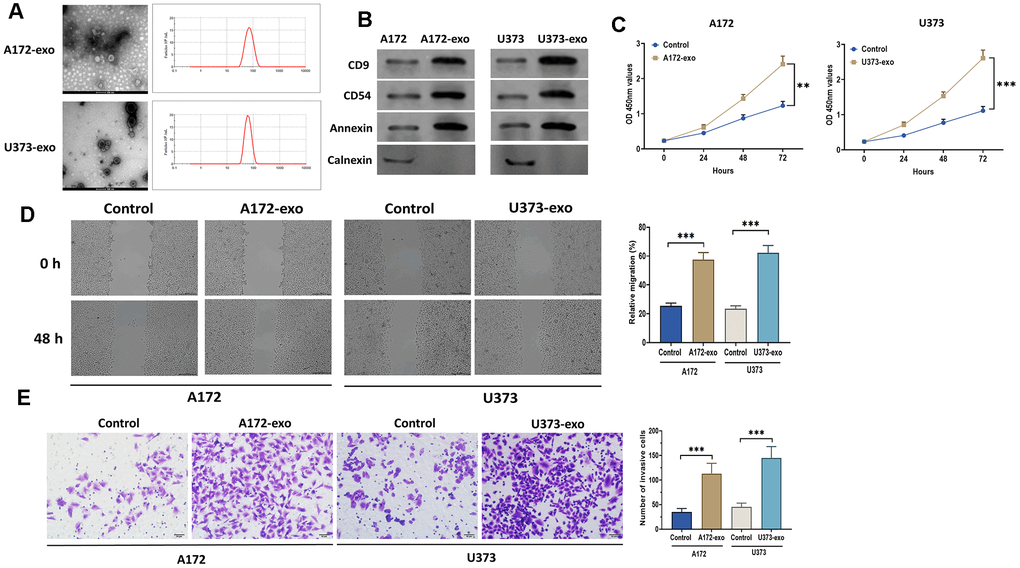 Glioma-derived exosomes promote glioma cell proliferation and migration. (A) The morphology and size distribution of EVs isolated from the supernatant of the culture medium of A172 and U373 cells, as detected by transmission electron microscopy and nanoparticle tracking analysis. scale bar = 100 nm. (B) Protein expressions of exosomal markers CD9, CD54, Annexin, and Calnexin in EVs and glioma cells. (C) Cell proliferation of glioma cells treated with exosomes isolated from A172 or U373 cells, as detected by CCK8 assay. (D) Wound healing assays in glioma cells treated with exosomes isolated from A172 or U373 cells. Scale bar = 200 μm. (E) Cell migration of glioma cells treated with exosomes isolated from A172 or U373 cells, as detected by Transwell invasion assay. Scale bar = 50 μm. Data were represented as mean ± SD. ** p 