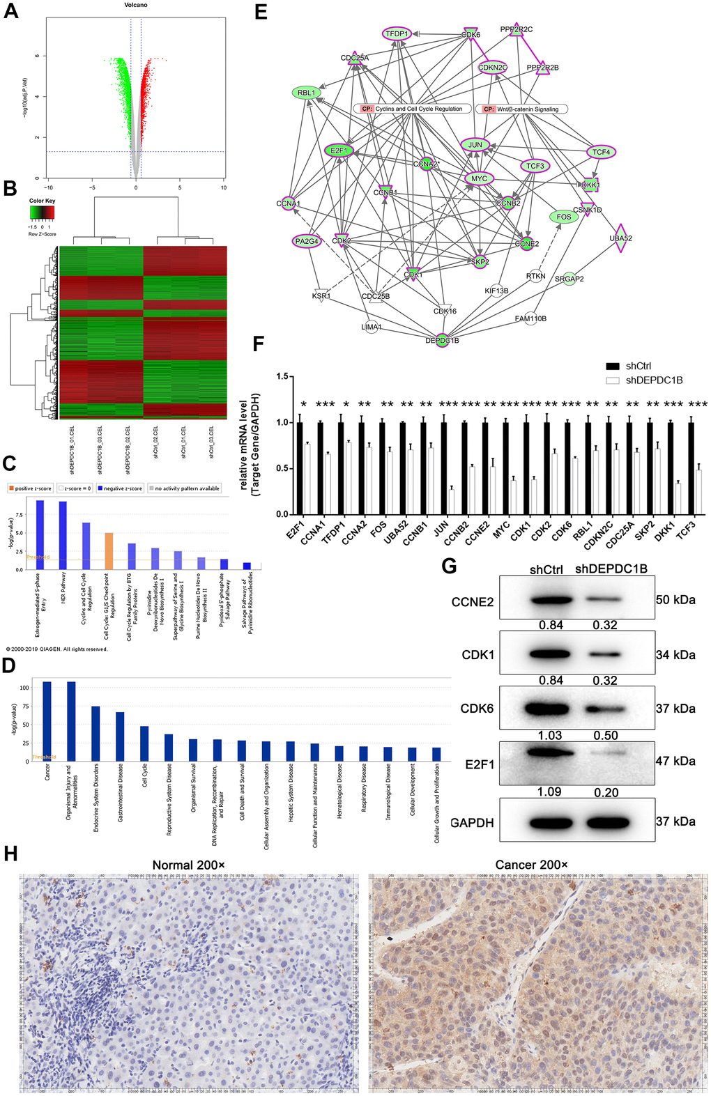 Obtained the DEGs by human GeneChip PrimeView and the expression at mRNA and protein level. (A) Genes were represented as red points or green points, when Fold Change ≤-1.5 and FDRB) Up-regulated genes and down-regulated genes were labeled as red and green, respectively. (C) Salvage Pathways of Pyrimidine Ribonucleotides, NER Pathway, Estrogen-mediated S-phase Entry, and Cyclins and Cell Cycle Regulation were significantly inhibited. (D) The enrichment of DEGS in disease and function. (E) The interaction network between DEPDC1B, Cyclins and Cell Cycle Regulation, and Wnt/β-catenin Signaling pathway. (F) The results of qRT-PCR showed that, compared to shCtrl group, the expression level of E2F1, CCNA1, TFDP1, CCNA2, FOS, UBA52, CCNB1, JUN, CCNB2, CCNE2, MYC, CDK1, CDK2, CDK6, RBL1, CDKN2C, CDC25A, SKP2, DKK1, and TCF3 was down-regulated (PG) The results of western blot showed that CCNE2, CDK1, CDK6, and E2F1was significantly down-regulated in shDEPDC1B group, compared to shCtrl group. (H) The results of IHC showed that the expression level of CDK1 in cancer tissues was higher than in normal tissues (scale bar = 50 μm).