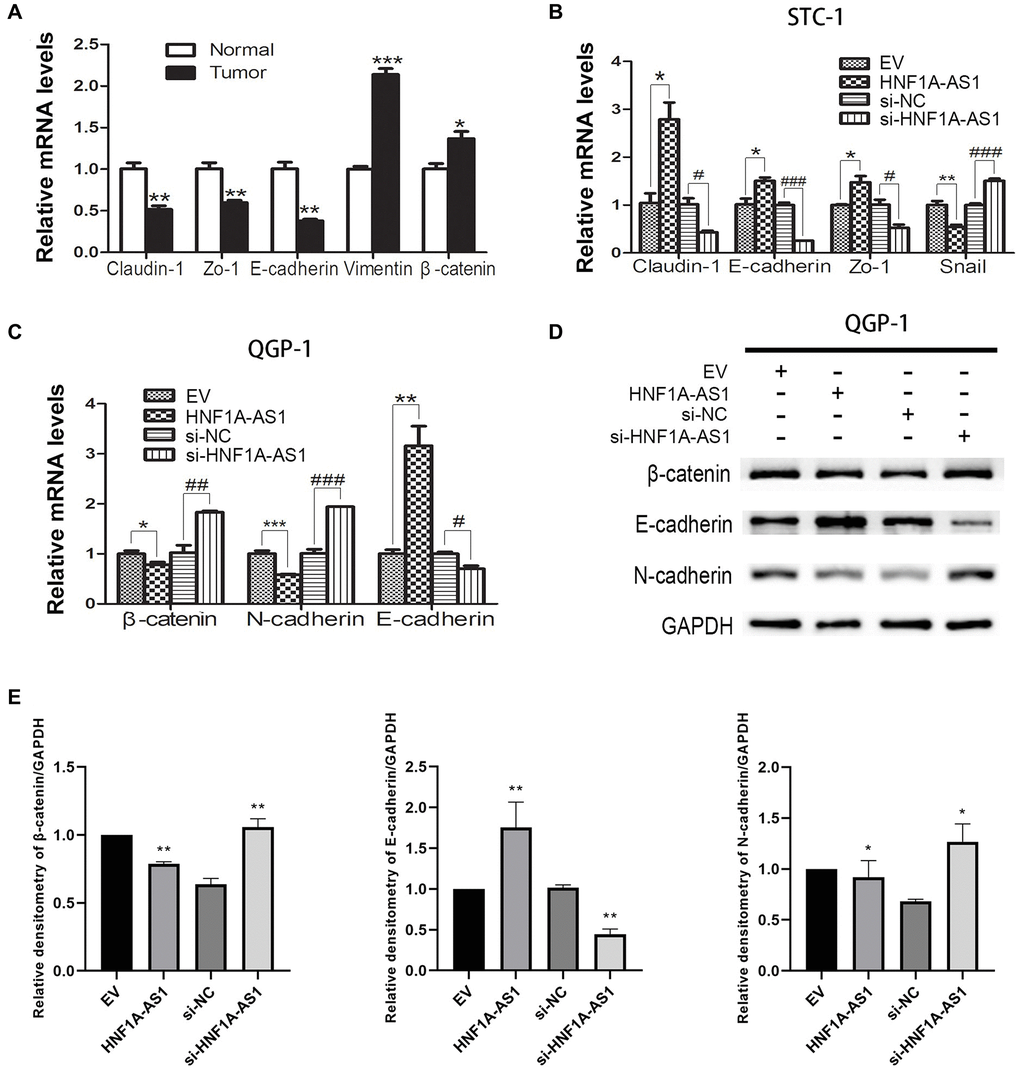 HNF1A-AS1 inhibited EMT process in GEP-NENs cells. (A) qRT-PCR was performed in G-NENs tissues to detect the EMT markers. (B–C) qRT-PCR was performed in GEP-NENs cells to detect the EMT markers. (D–E) Western blot was used to validate the level of EMT markers in GEP-NENs cells. *p **p 