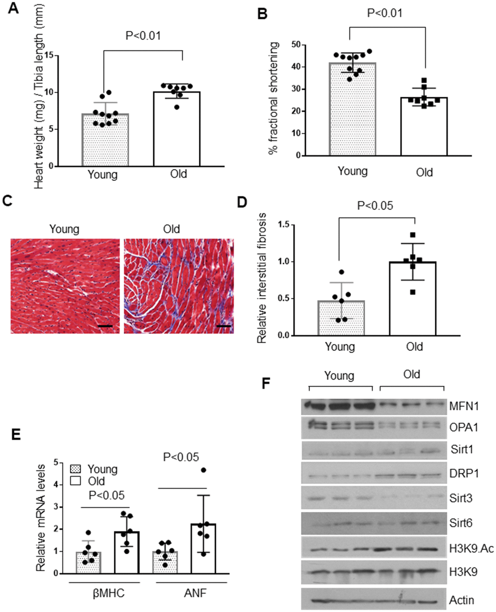 Aged mice show cardiac hypertrophic response. (A) Heart weight to tibia length (HW/TL) ratio of 4-month-old (Young) and 24-month-old (Old) mice. Values are mean ± SE, n = 8-10. (B) Echocardiographic measurements of fractional shortening in young and old mice. Values are mean ± SE, n = 8-10. (C) Representative sections of hearts stained with Masson's trichrome to detect fibrosis (blue); scale bars, 20 μm. (D) Quantification of cardiac fibrosis in young and old mice. Mean ± SE, n = 6. (E) Expression levels of βMHC and ANF mRNA in young and old mice, mean ± SE, n = 6 mice. (F) Heart lysates of young and old mice were subjected to immunoblotting using indicated antibodies. Representative blots of three different mice in each group are shown, n = 6. (Quantification of blots is given in Supplementary Figure 3A–3E).