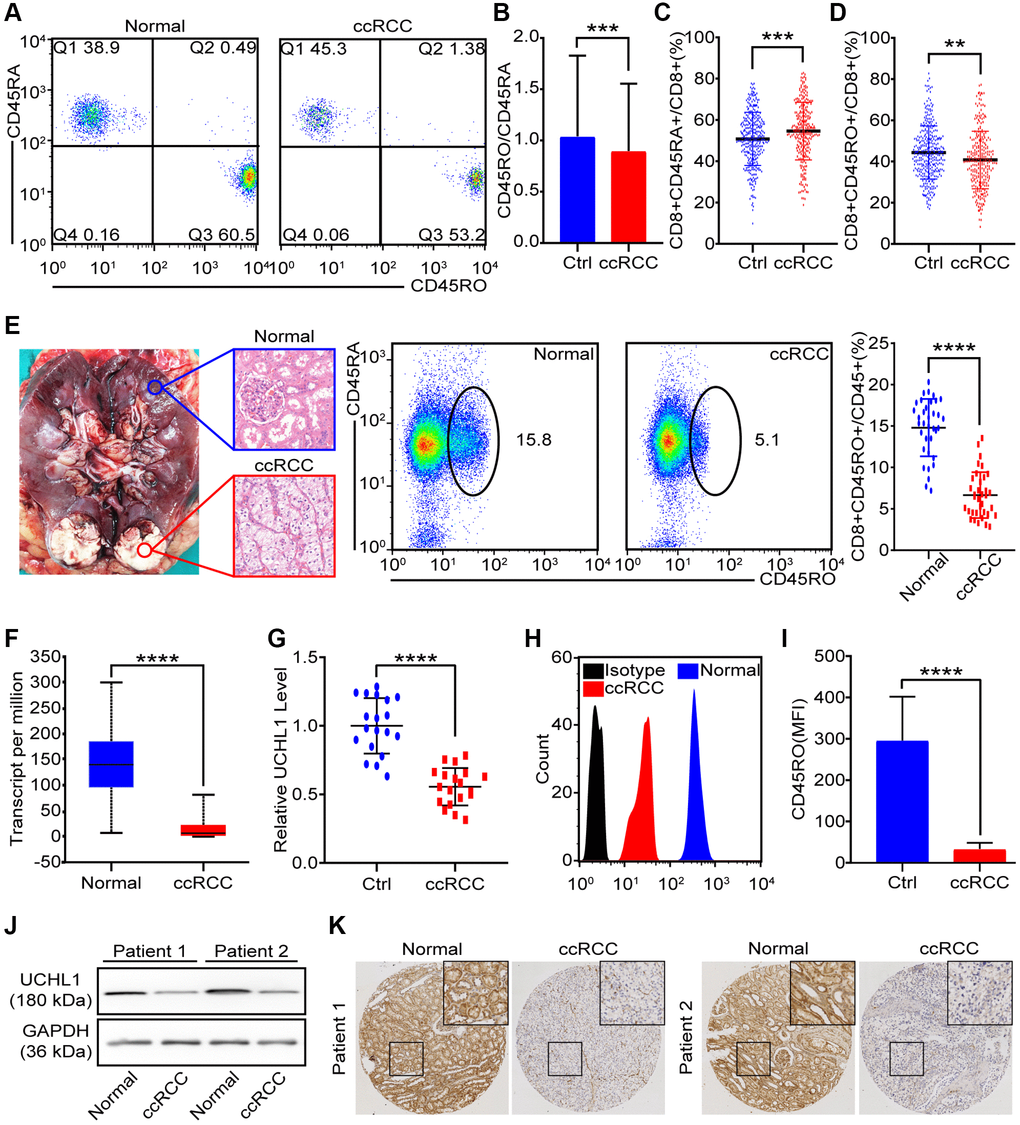 CD45RO+CD8+ T cells decreased in ccRCC tissues. We collected PBMCs and renal tissues to analysis proportion of CD45RO+CD8+ T cells/CD45RA+CD8+ T cells. (A) Flow cytometry representative image of CD45RO+CD8+ T cells/CD45RA+CD8+ T cells from healthy people and ccRCC patients. (B, C) Proportion of CD45RA+CD8+T cells (B) and CD45RO+CD8+ T cells (C) of CD8+ T cells from healthy people and ccRCC patients. (D) Ratio of CD45RA+CD8+ T cells and CD45RO+CD8+ T cells in peripheral blood of healthy people and ccRCC patients. (E) Pathologically confirmed adjacent normal renal tissues (n = 35) and ccRCC tissues (n = 35) were collected and flow cytometry was used to test proportion of CD45RO+CD8+ T cells. (F) Transcript level of UCHL1 (gene name of CD45RO) in normal renal tissues and ccRCC tissues according to TCGA database. (G) Transcript level of UCHL1 in adjacent normal renal tissues (n = 20) and ccRCC tissues (n = 20). (H, I) Flow cytometry was used to test CD45RO fluorescence intensity of CD8+ T cells (H) and MFI was counted (I). (J, K) CD45RO protein levels of adjacent normal renal tissues (n = 35) and ccRCC tissues (n = 35) were tested by western blot and IHC. Means±SEM of experiment performed in triplicates are shown. *P **p ***p 