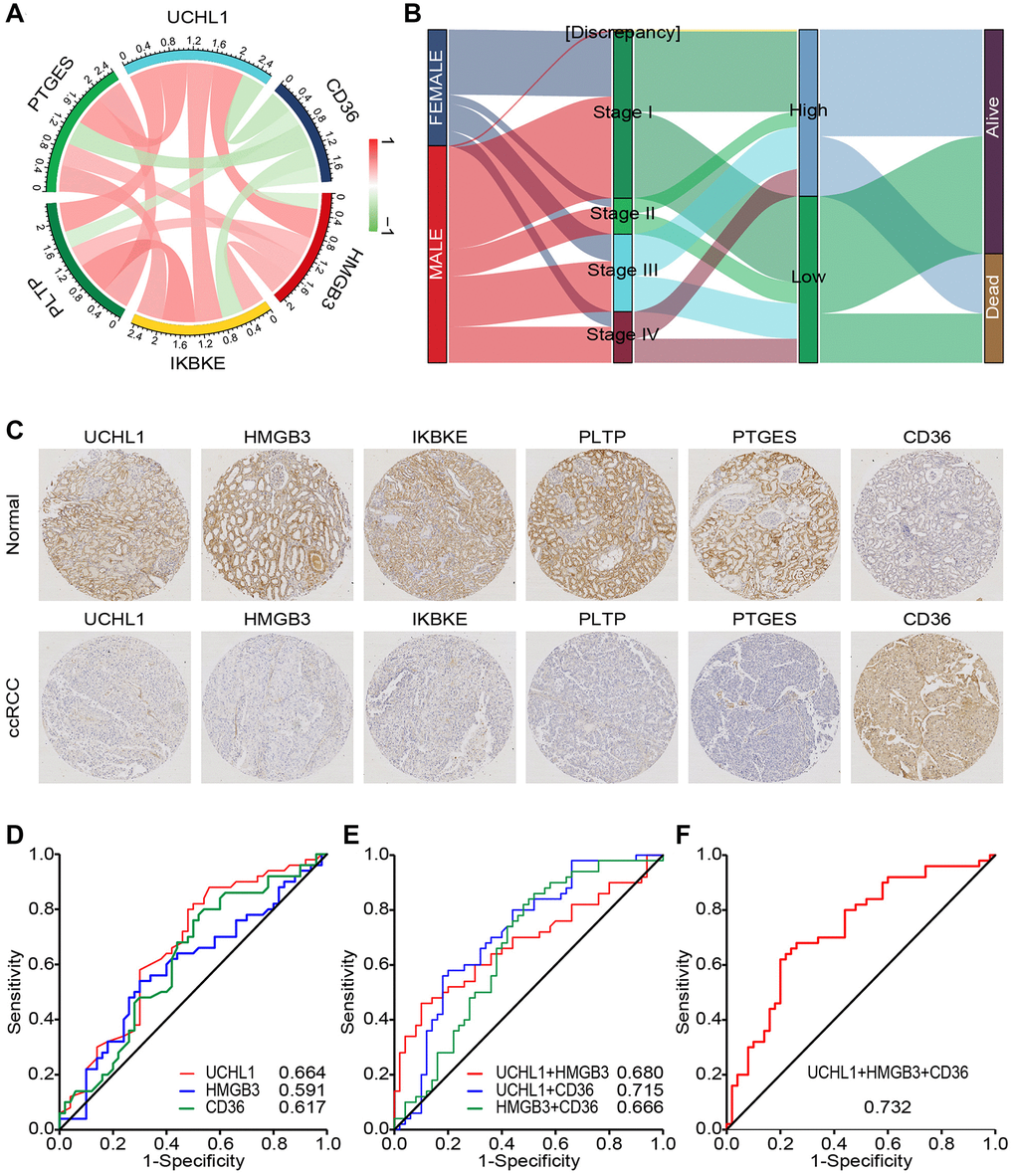 CD45RO combined with related proteins is an effectively diagnostic marker for ccRCC. (A) The relations between UCHL1 and related genes. Color and line weight represent correlation coefficients. Red: positively related Green: negatively related. (B) The correlation and distribution of 2 groups among clinical characteristics in ccRCC patients. Expression level: log2(FPKM+0.01). (C) Preventive images of ccRCC tissues and normal renal tissues incubated with UCHL1, CD36, HMGB3, IKBKE, PTLP and PTGES anti-body. (D) ROC curve analyses for evaluating the diagnostic potential of UCHL1, CD36 and HMGB3 for ccRCC. (E) ROC curve analyses for evaluating the diagnostic potential of UCHL1- CD36, UCHL1 - HMGB3, and HMGB3- CD36 for ccRCC. (F) ROC curve analyses for evaluating the diagnostic potential of UCHL1- CD36- HMGB3 for ccRCC.