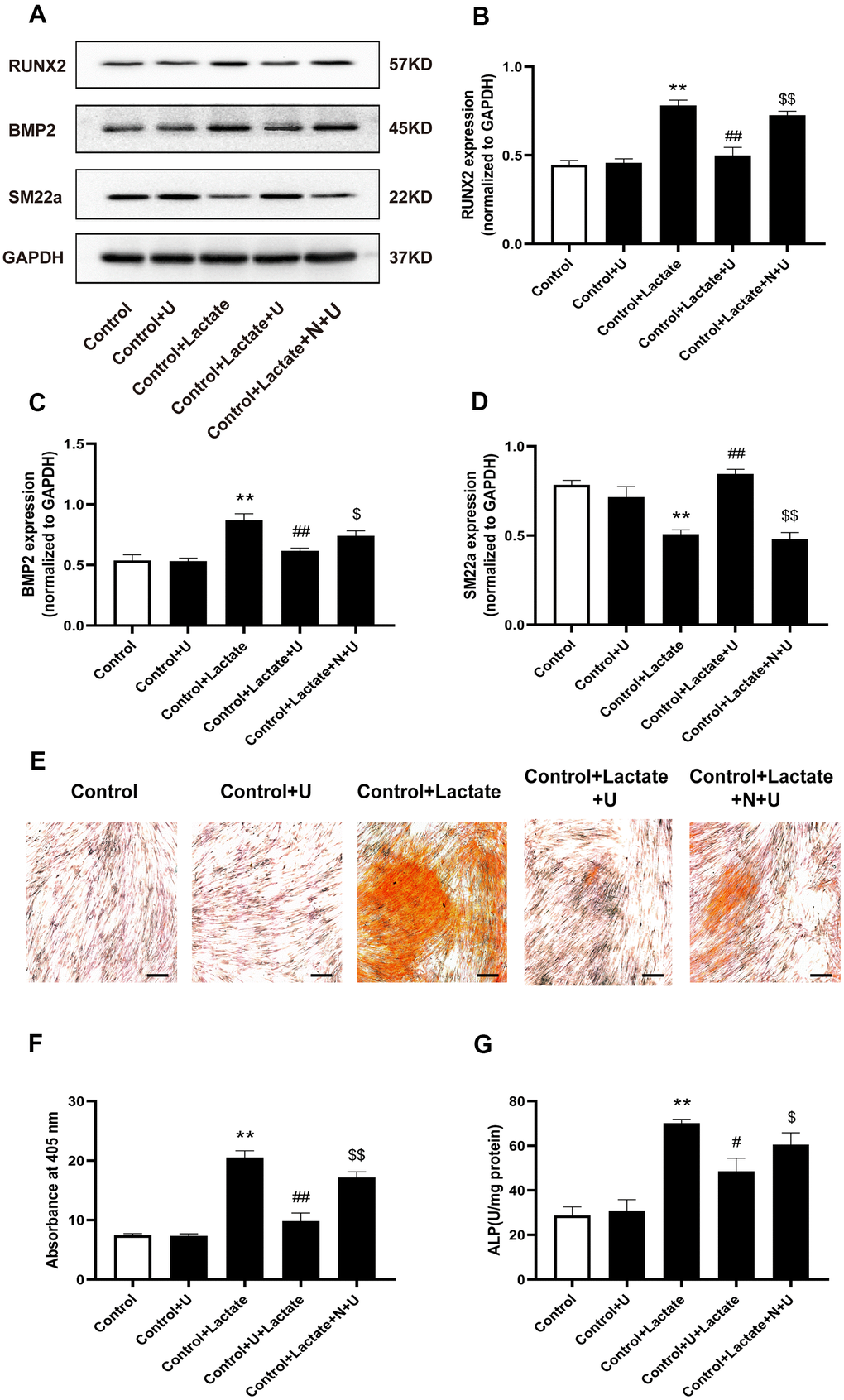 Effects of κ-OR stimulation on the expression of osteogenic proteins in VSMCs treated with lactate. (A) Representative blot images of osteogenic differentiation-associated proteins. (B) Quantitative analysis of RUN2 protein expression using densitometry. (C) Quantitative analysis of BMP2 protein expression using densitometry. (D) Quantitative analysis of SM22a protein expression using densitometry. (E) Calcium nodules were stained with Alizarin red. Red nodules indicate calcium deposition. Scale bar = 50 μm. (F) Quantification of mineralization (mean ± SEM; n = 6). (G) ALP activity was detected using ALP activity kits. Data were normalized using log10 and analyzed using one-way ANOVA tests; U, U50,488H; N, nor-BNI; Data obtained from quantitative densitometry were presented as means ± SEM. n=5 in each group. *P **P #P ##P $P $$P 