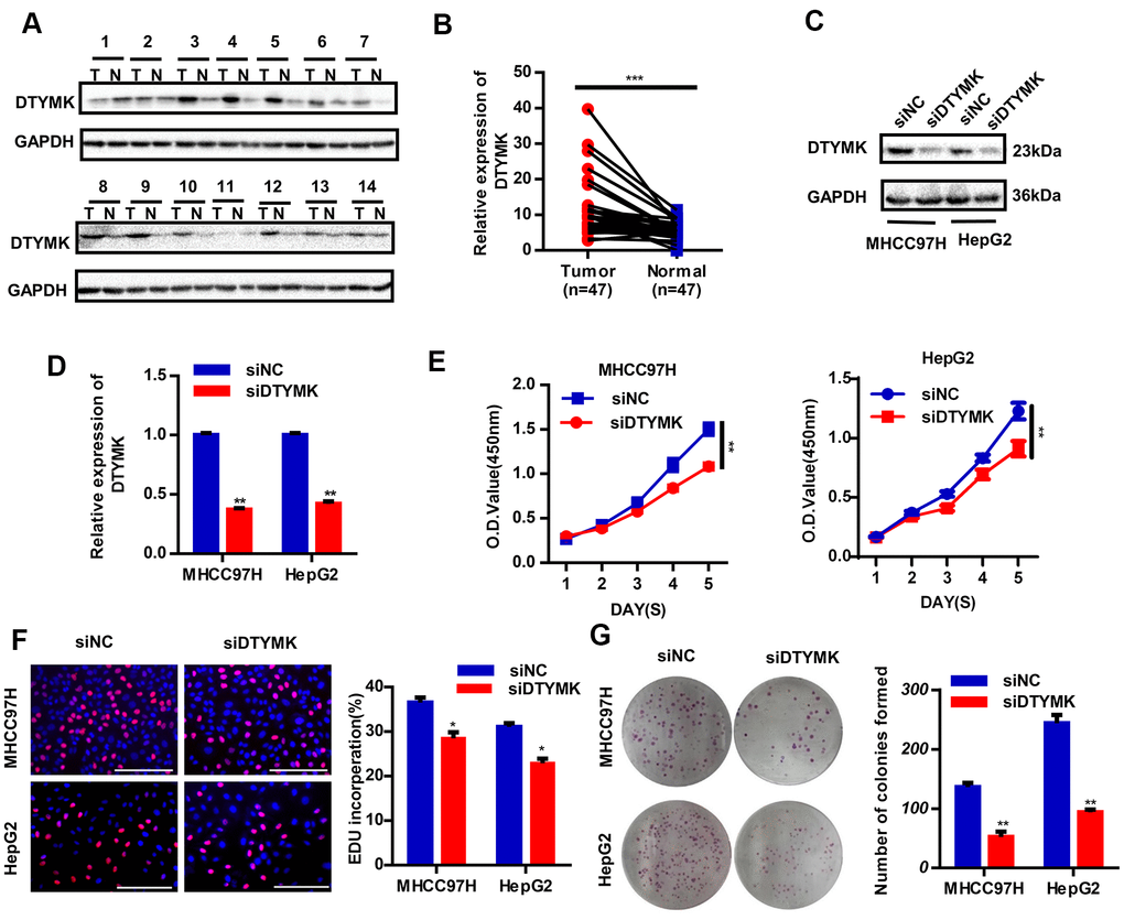 Validation of DTYMK’s expression and function. (A) The expression levels of DTYMK in HCC and adjacent noncancer tissues were evaluated by Western blot (n=47). (B) Statistical analysis of relative DTYMK levels in HCC tissues compared to normal tissue controls (n= 47). (C, D) Transfection efficiency was verified after transfection of siDTYMK or negative control siRNA. (E) HCC cell viability was evaluated with CCK-8 assays. (F) EdU assay showed change of proliferative rate after transfection with siDTYMK. (G) The number of HCC cell colonies was reduced after transfection with siDTYMK. *** represents p 