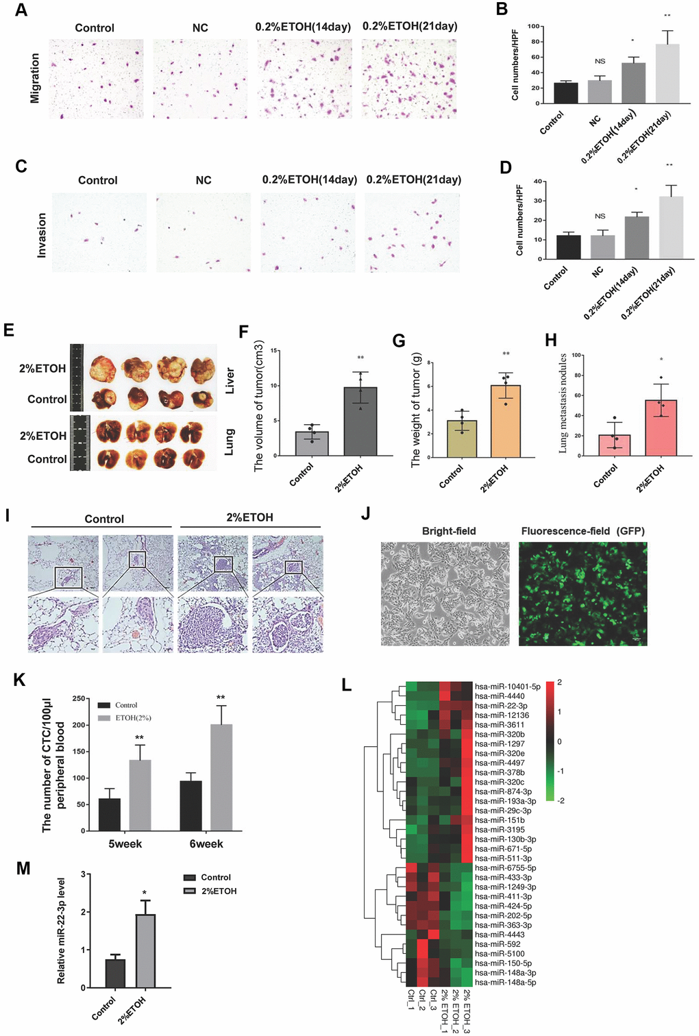 Chronic alcohol exposure promotes HCC metastasis. (A) A representative image showing the migration of control, negative control (NC) and chronic alcohol-induced HCC cells. (B) The migrated cells were quantified and shown in column graph. *PPC) A representative image showing the invasion of control, NC and chronic alcohol-induced HCC cells. (D) The invaded cells were quantified and shown in column graph. *PPE) Typical anatomical images of orthotopic liver tumors and lung metastasis nodules from the control group and alcohol drinking nude mice. (F) The volume of orthotopic liver tumors from the control group and alcohol drinking nude mice. Each group consisted of four mice. **PG) The weight of orthotopic liver tumors from the control group and alcohol drinking nude mice. Each group consisted of four mice. **P H) The number of lung metastasis nodules from the control group and alcohol drinking nude mice was quantified. Each group consisted of four mice. *PI) HE images of lung metastasis nodules from the control group and alcohol drinking nude mice. (J) The bright-field and fluorescence-field images of GFP-labelled HCC-LM3 cells. (K) The number of CTCs in peripheral blood of the orthotopic tumor model mice. **PL) microRNA-sequencing results of liver tumor tissues from the control group and alcohol drinking nude mice. (M) The expression level of miR-22-3p in tumors from the control group and alcohol drinking nude mice. Each group consisted of four mice. *P