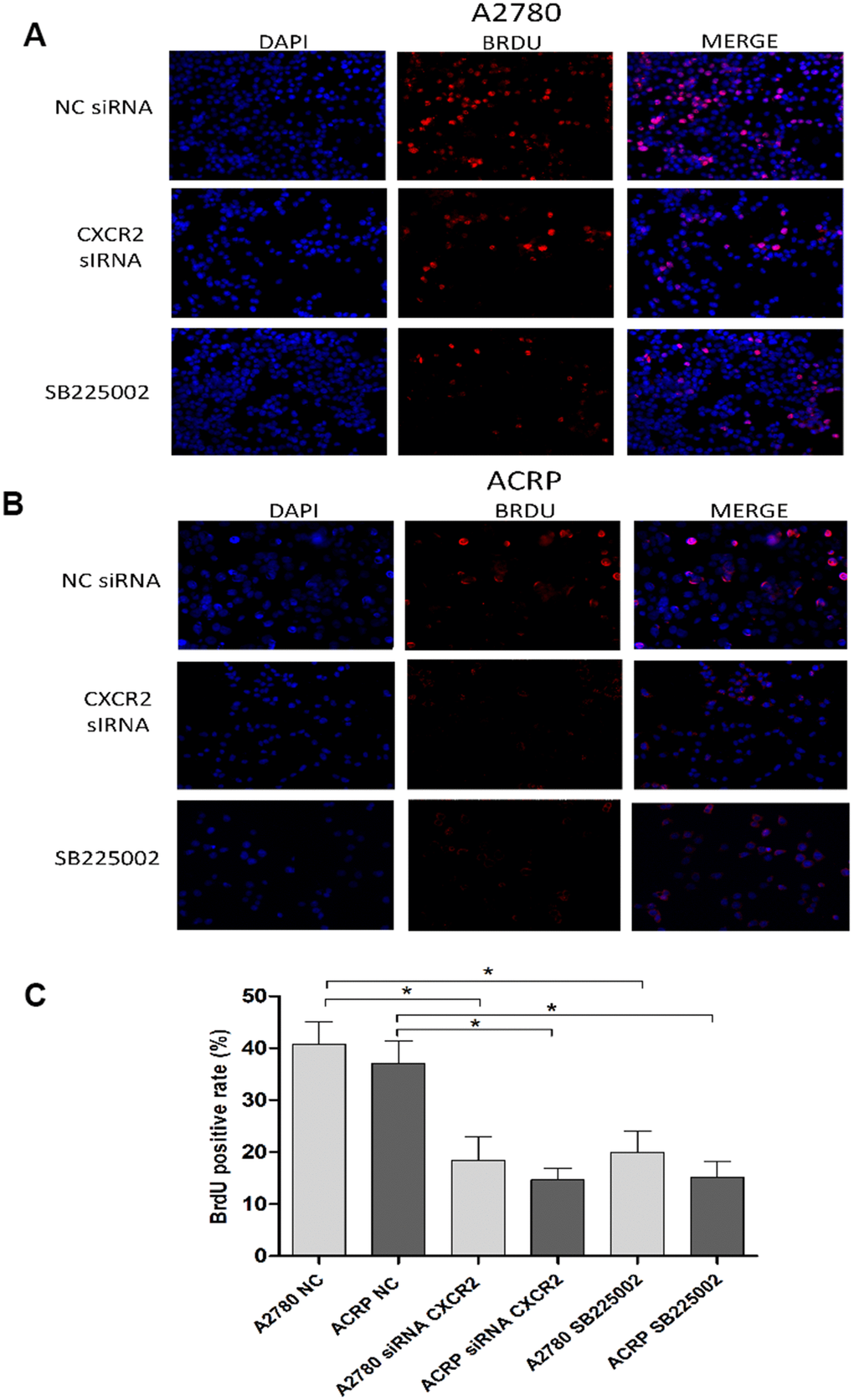 CXCR2 enhances OC cell proliferation. BrdU immunofluorescence assays were conducted to investigate the role of CXCR2 on OC cell proliferation. In brief, cells were plated at the same density and fixed, as previously reported. Antibody against the marker of cell proliferation, BrdU, was conjugated with PE (red), whereas cells nuclei were stained with DAPI (blue). Finally, both staining conditions were merged for better visualization of the studied phenomenon. (A) A2780 cells were either transfected with empty vector for control (NC), siRNA CXCR2 (10μM) or treated with the CXCR2 antagonist SB225002 (1ug/ml). (B) ACRP cells were either transfected with empty vector for control (NC), siRNA CXCR2 (10μM) or treated with the CXCR2 antagonist SB225002 (1ug/ml). (C) BrdU positive rate, indicating cell proliferation under each specified experimental condition. Note that cell proliferation decreased significantly both in the KD models and under treatment of cells with SB225002. Cell proliferation was remarkably lower in ACRP cells vs. A2780 cells in all events. Figure is of a representative experiment. Data was analyzed by one-way ANOVA. *p