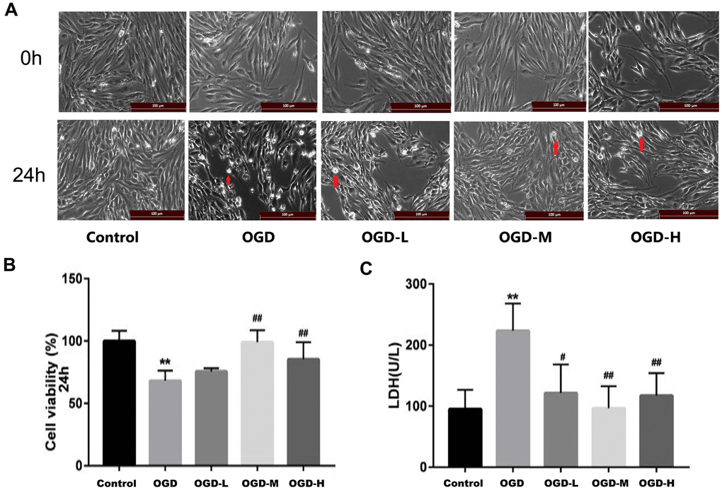 Effects of Alisol A 24-acetate on the morphology and viability of bEnd.3 cells after OGD injury. (A) Cells were observed under an inverted microscope after oxygen-glucose deprivation (OGD) (scale bar 100 μm). (B) Cell viability was calculated by the CCK-8 assay. (C) Secreted LDH levels in cell culture supernatant were determined by the LDH kit (OGD-L: 1.9 umol/L Alisol A 24-acetate; OGD-M: 19 umol/L Alisol A 24-acetate; OGD-H: 38 umol/L Alisol A 24-acetate). Results are described as means ± SD (n = 6) (**P ##P 