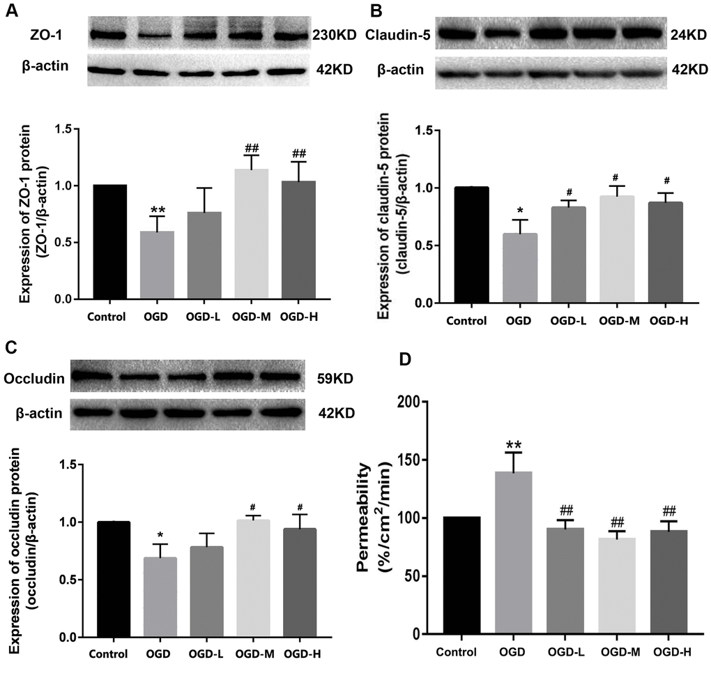 Expression of TJ proteins and the permeability in OGD-induced bEnd.3 cells. (A–C) Western blot analysis was performed to determine the expressions of ZO-1, claudin-5, and occludin. The amount of TJ proteins was quantified and normalized to that of β-actin. Results are described as means ± SD (n = 3). (D) Quantification of fluorescein isothiocyanate (FITC)-Dextran was conducted to assess cellular permeability. Results are described as the mean ± SD (n = 6) (OGD-L: 1.9 umol/L Alisol A 24-acetate; OGD-M: 19 umol/L Alisol A 24-acetate; OGD-H: 38 umol/L Alisol A 24-acetate) (*P P #P ##P 