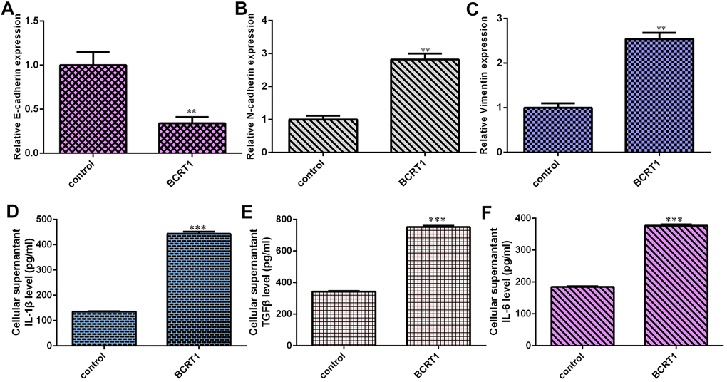 BCRT1 induced EMT progression and inflammatory mediators secretion in osteosarcoma cell. (A) Overexpression of BCRT1 inhibited E-cadherin expression in MG-63 cell. (B) The expression of N-cadherin was detected by qRT-PCR assay. (C) The level of vimentin was measured using qRT-PCR assay. (D) Elevated expression of BCRT1 induced IL-1β secretion. (E) The level of TGFβ was determined by ELISA assay. (F) The level of IL-6 was measured by ELISA assay. **p