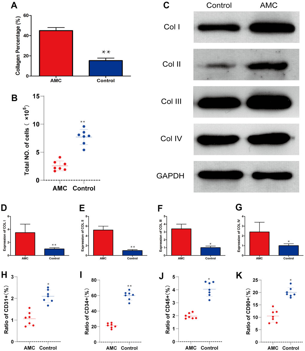 Collagen and cell percentage in AMC and Coleman fat. (A) Collagen percentage in AMC and Coleman fat (control) before grafting, as calculated by quantification of the positive area in Masson stained sections. (B) Total number of cells in AMC and Coleman fat (control) before grafting. (C) Expression of Collagen I, II, III, and IV in AMC and Coleman fat (control) before grafting. (D) Quantification of collagen I expression in AMC and Coleman fat (control) before grafting. (E) Quantification of collagen II expression in AMC and Coleman fat (control) before grafting. (F) Quantification of collagen III expression in AMC and Coleman fat (control group) before grafting. (G) Quantification of collagen IV expression in AMC and Coleman fat (control group) before grafting. (H) Ratio of CD31+ cells in AMC and Coleman fat (control group) before grafting, calculated by flow cytometry. (I) Ratio of CD31+ cells in AMC and Coleman fat (control group) before grafting, calculated by flow cytometry. (J) Ratio of CD90+ cells in AMC and Coleman fat (control group) before grafting, calculated by flow cytometry. (K) Ratio of CD45+ cells in AMC and Coleman fat (control group) before grafting, calculated by flow cytometry. Results are presented as the mean ± SD (n = 7 per group). * control vs. AMC; P vs. AMC; P 