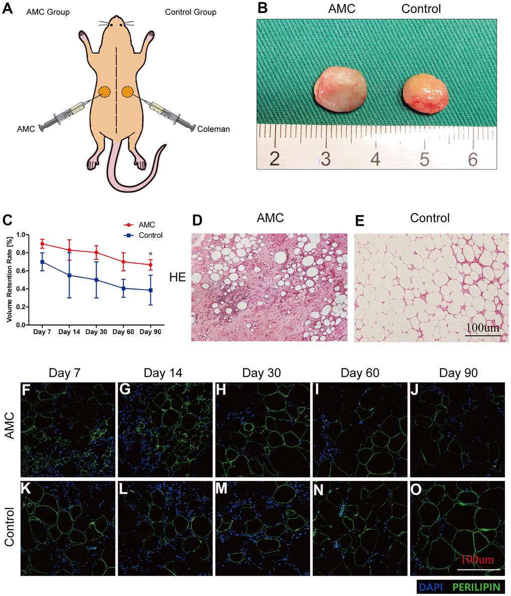 Retention and tissue structure of AMC and Coleman fat after grafting. (A) Transplantation of AMC and Coleman fat (control group) into nude mice. (B) Outward appearance of grafts in AMC and Coleman fat (control group) on Day 90. (C) Retention rates of grafts in AMC and Coleman fat (control group) on Days 7, 14, 30, 60, and 90 after grafting. (D, E) Hematoxylin/eosin staining of grafts in AMC and Coleman fat (control group) on Day 90 after grafting. (F–O) Immunofluorescence staining of grafts in AMC and Coleman fat (control group) on Days 7, 14, 30, 60, and 90. PERILIPIN+ (green) indicates adipose cells. DAPI+ (blue) indicates cell nuclei. Results are presented as the mean ± SD (n = 7 per group). * P vs. AMC; ** P vs. AMC.