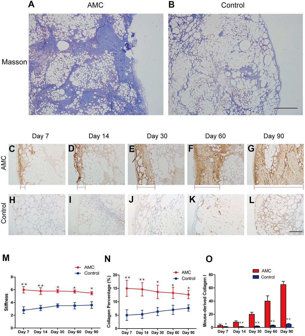 Changes in collagen in AMC and Coleman fat after grafting. (A, B) Masson’s trichrome staining of grafts in AMC and Coleman fat (control) on Day 90 after grafting. (C–L) Immunohistochemical staining of mouse type I collagen in grafts of AMC and Coleman fat (control) on Days 7, 14, 30, 60 and 90. Red line: type I collagen thickness, from the outermost to the innermost of grafts. (M) Stiffness analysis of grafts of AMC and Coleman fat (control) on Days 7, 14, 30, 60, and 90 after grafting. (N) Collagen percentage in grafts of AMC and Coleman fat (control) on Days 7, 14, 30, 60, and 90, calculated by quantification of positive area in Masson stained sections. (O) Quantification of the area positive for mouse collagen I immunohistochemical staining in grafts of AMC and Coleman fat (control) on Days 7, 14, 30, 60 and 90. Results are presented as the mean ± SD (n = 7 per group). * P vs. AMC; **, control vs. AMC; P 