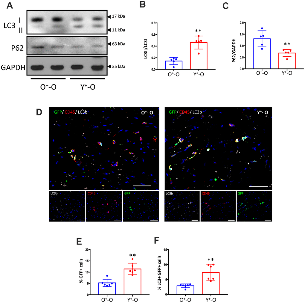 Heterochronic bone marrow reconstitution by Y-Sca-1+ BMCs is associated with enhanced autophagy in the aged mouse heart. (A) LC3I, II and p62 protein levels were measured in old mice hearts, reconstituted with GFP+young-Sca-1+ (Y+-O) or GFP+old-Sca-1+ (O+-O) bone marrow cells (BMCs) by Western blotting. (B, C) Band intensities shown in panel (A) were quantified to measure LC3II/I ratio or p62 levels. Data were normalized to loading control GAPDH. (D) Immunofluorescent staining was performed on sections of Y+-O and O+-O myocardium. LC3b is indicated by yellow, CD45 by red, GFP+ BMCs by green, and nuclei by blue. Scale bar represents 50 μm. Percentage of GFP+ cells (E), or LC3+ and GFP+ cells (F) in panel (D) were quantified. Scale bars represent 50 μm. T-test used to analyze data. n=5-6; *p≤0.05; **p≤0.01.