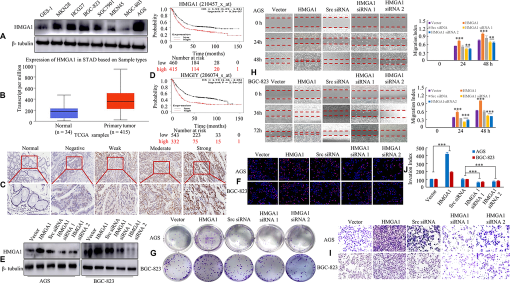 HMGA1 expression is associated with the biological behavior of GC. (A) HMGA1 protein levels were assessed in GC cell lines and a human normal gastric epithelial cell line GES-1 using western blotting. β- tubulin was used as the internal control. (B) The protein expression of HMGA1 in GC and normal tissues analyzed by UALCAN cancer database. (C) IHC signal intensities were scored as nontumorous gastric mucosa (Normal), negative, weak, moderate and strong expression of HMGA1 protein in GC tissue. (D) OS survival curves of all GC patients cohorts (N = 875 and N = 875) from the KM plotter databases. N = number; OS, overall survival. (E) The protein levels of HMGA1 in AGS and BGC-823 cells with three treatments [Scrambled (Scr) siRNA, HMGA1 siRNA 1 and HMGA1 siRNA 2] determined by western blot analysis. (F) The GC cells transfected with the ectopic expression or knockdown of HMGA1 gene at 48 h and then stained with EdU and Hoechst 33342. (G) The AGS and BGC-823 cells were tested for the ability to form soft agar colonies. (H) Relative wound density at different time points of GC cells over a period of 48 h or 72 h. The measurements are from wounds made on a monolayer of GC cells cultured in the presence of different coating treatments and control. Original magnification, 10x. **, P I, J) In vitro the invasive ability of AGS and BGC-823 cells were evaluated by Transwell assay. The relative ratio of invasive cells was counted. ***, P C); 100 μm in (F).