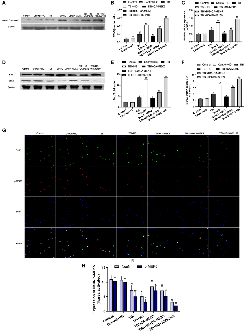 HG increased TBI-induced apoptosis by inhibiting the MEK5/ERK5 pathway. (A) CC-3 and (D) Bax/Bcl-2 protein bands in scratched and transfected primary hippocampal cells. Bar graphs illustrate densitometric analyses of the Western blot protein bands for (B) CC-3 and (E) Bax/Bcl-2, each normalized to β-actin. Bar graphs illustrate quantitative analyses of (C) CC-3 and (F) Bax/Bcl-2 mRNA levels, each normalized to β-actin. (G) Double immunofluorescent staining of NeuN and p-MEK5. Representative confocal images stained for p-MEK5 (red) and NeuN (green) demonstrate that CA-MEK5 treatment not only increased p-MEK5 protein levels, but also markedly increased neuronal survival (scale bar, 100 μm). (H) Staining for NeuN and p-MEK5 was analyzed using MATLAB software. Data are presented as the mean ± standard deviation (n = 5 per group). #P *P **P &P &&P 