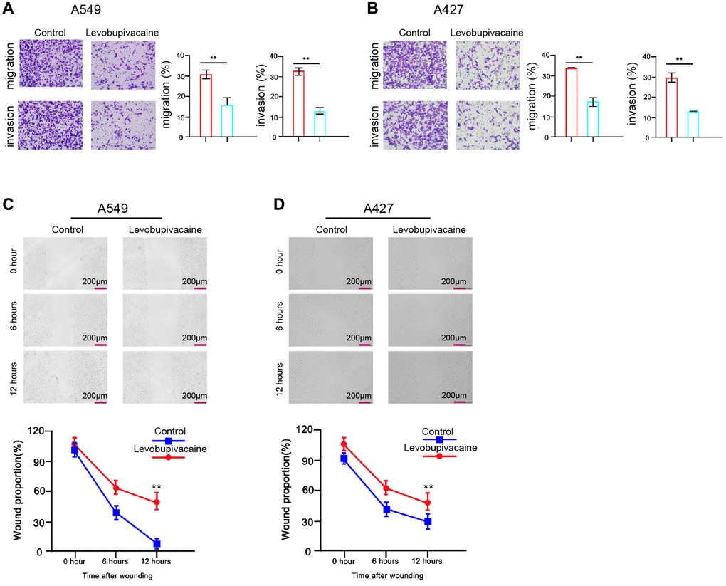 Levobupivacaine represses invasion and migration of NSCLC cells. (A–D) The A549 and A427 cells were treated with levobupivacaine (2 mM) or equal volume saline. (A and B) The cell migration and invasion were examined by transwell assays in the cells. (C and D) The migration and invasion were measured by wound healing assays in the cells. The wound healing proportion was shown. Data are presented as mean ± SD. Statistic significant differences were indicated: **P 