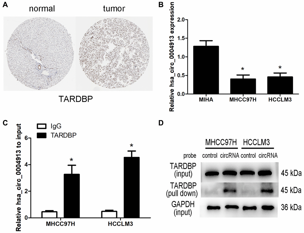 Analysis of TARDBP- hsa