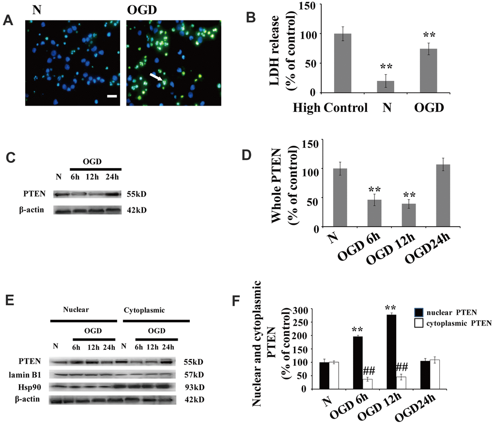 OGD increases PTEN nuclear translocation in cultured neurons (A) TUNEL-positive cells increased 12 h after OGD. The arrow indicates TUNEL-positive cells with green fluorescence. Scale bars = 50 μm. (B) Extracellular LDH levels were elevated at 12 h after OGD. (C) The PTEN whole cell protein levels decreased between 6 h and 12 h after OGD. (D) Quantification of the whole cell protein levels of PTEN. (E) Western blot analysis of the cytoplasmic and nuclear fractions showed that nuclear PTEN significantly increased 6 h after OGD, reaching a peak at 12 h, and returned to control levels within 24 h. Blots were re-probed using cytoplasmic and nuclear protein markers, Hsp90 and lamin B1, respectively. (F) Quantification of PTEN protein levels in cytoplasmic and nuclear fractions. Data were quantified by densitometry and normalized against healthy neurons. n = 5 for each column. **p 