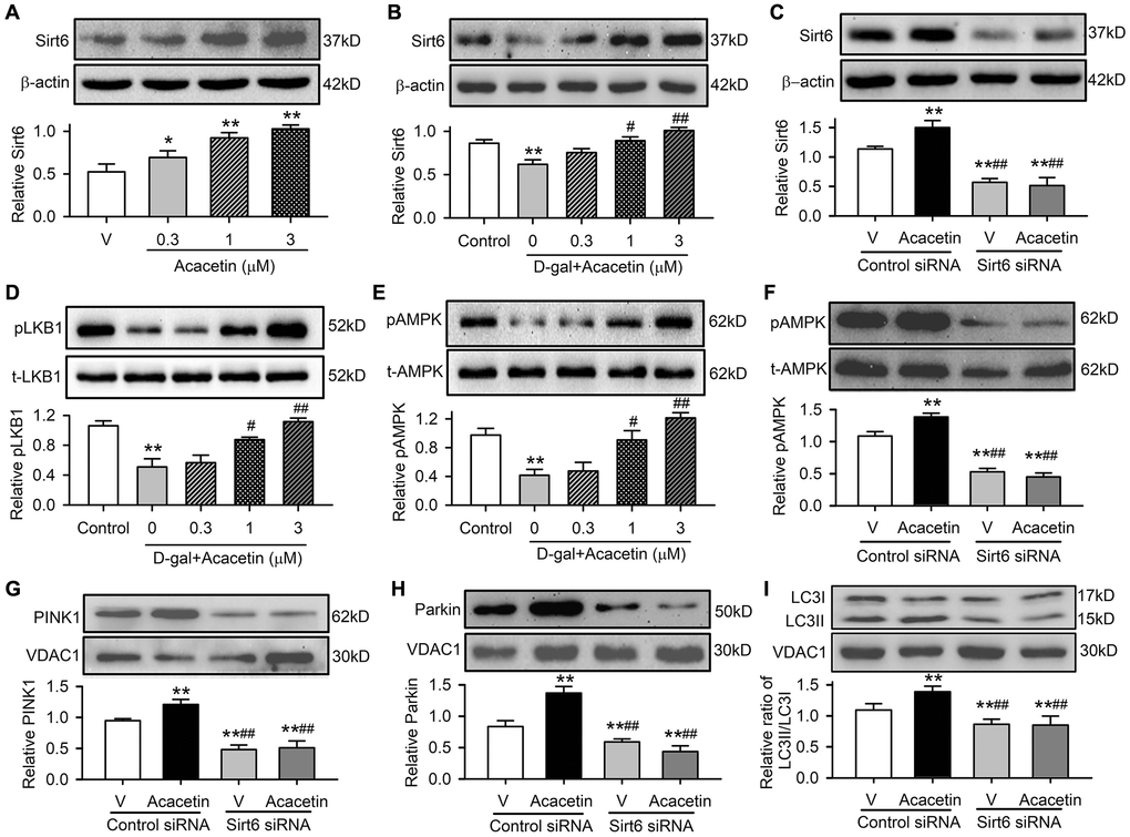 Sirt6 mediates acacetin-induced reversal of the downregulation of pLKB1, pAMPK and mitophagy signaling in H9C2 cells by D-galactose. (A) Western blots and relative levels of Sirt6 protein in cells treated without (V, vehicle) or with 0.3, 1 or 3 μM) for 72 h. (B) Western blots and relative levels of Sirt6 in cells treated without (control) or with D-galactose (D-gal, 20 mg/mL) or D-galactose plus acacetin (0.3, 1 or 3 μM) for 72 h. (C) Western blots and relative levels of Sirt6 protein in cells transfected with control siRNA or Sirt6 siRNA in the absence (V, vehicle) or presence of 3 μM acacetin. (D) Western blots and relative levels of pLKB1 in cells treated as in (B). (E) Western blots and relative levels of pAMPK in cells treated as in (B). (F) Western blots and relative levels of pAMPK in cells treated as in (C). (G) Western blots and relative levels of PINK1 in cells treated as in (C). (H) Western blots and relative levels of Parkin in cells treated as in (C). (I) Western blots and relative levels of LC3II/LC3I ratio in cells treated as in (C). (n = 5, *P **P #P ##P 