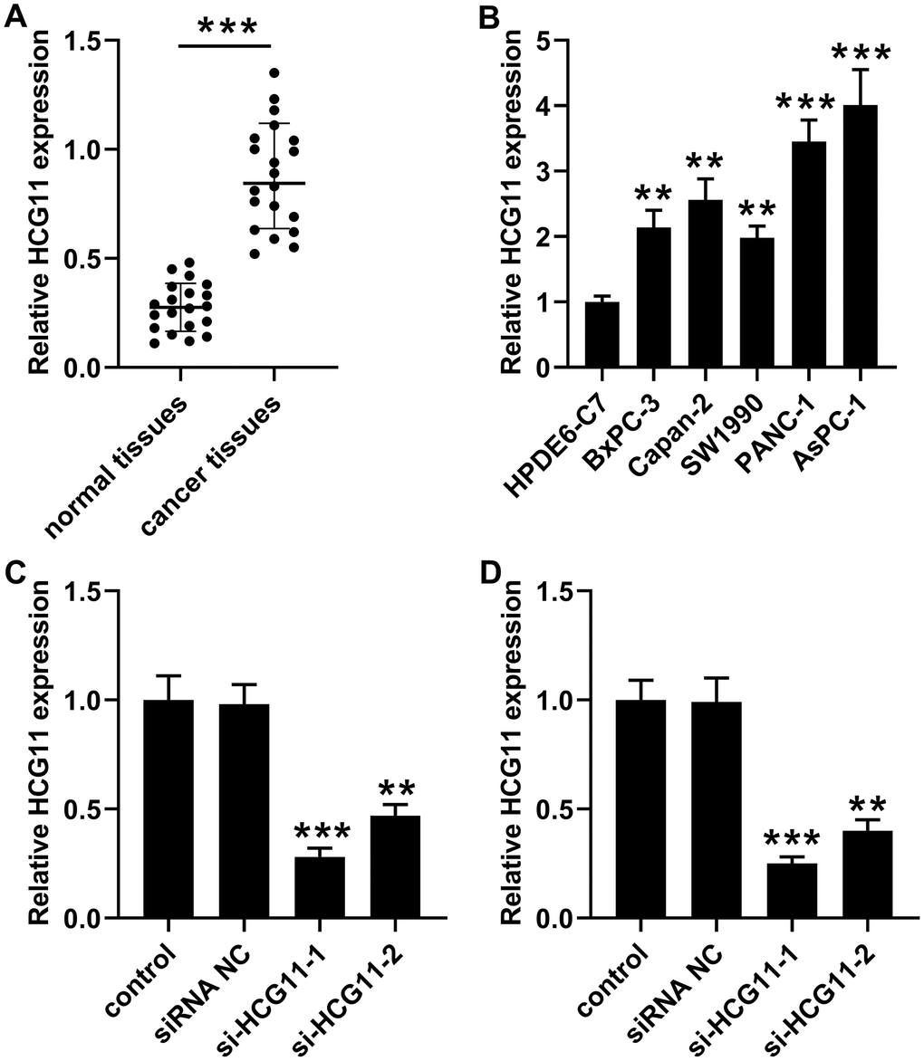 High expression of HCG11 was observed in pancreatic carcinoma tissues and cells. (A) qPCR assay was performed to detect HCG11 expression in 20 pairs of pancreatic carcinoma tissues and corresponding normal tissues. ***pB) HCG11 expression in pancreatic carcinoma cell lines (BxPC-3, Capan-2, SW1990, PANC-1 and AsPC-1) was also detected by qPCR. **p***pC, D) With transfected si-HCG11-1 or si-HCG11-2 in PANC-1 and AsPC-1 cells, qPCR was applied to detect HCG11 expression. **p***p