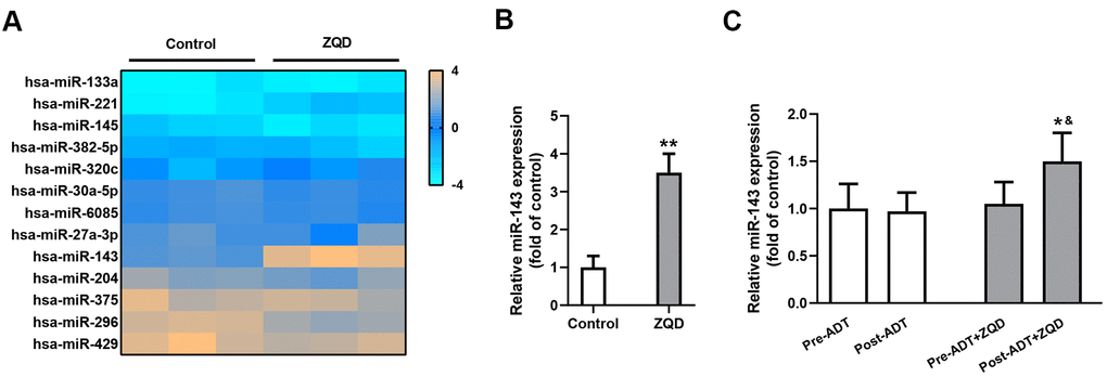 Zhoushi Qiling decoction modulates the expression of miR-143 in DU145 human prostate cancer cells and patient serum samples. (A) Relative expression levels of miRNAs in DU145 were checked by microarray after 24 hours of treatment with 50 mg/mL ZQD. (B) miR-143 expression levels in DU145 cells were analyzed by qRT-PCR. Data were expressed as mean ± SD from three independent experiments with triple replicates per experiment. ** p C) miR-143 expression levels in patient serum samples of ADT (n=68) and ADT+ZQD (n=65) groups were analyzed by qRT-PCR. Data were expressed as mean ± SD. * p &p 