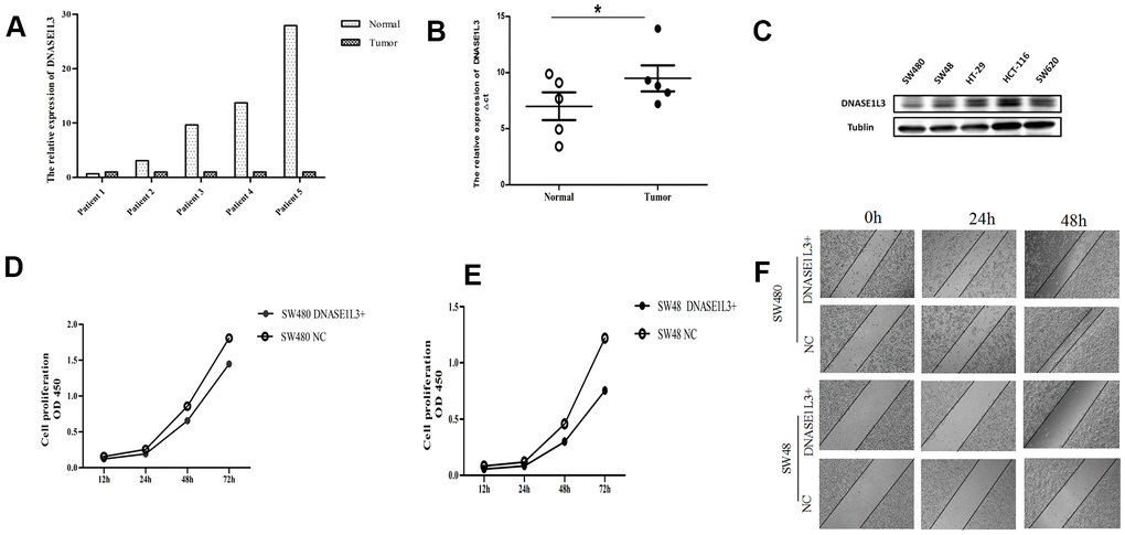 Expression of DNASE1L3 in colon cancer tissue samples and its effect on proliferation and motor ability of colon cancer cells. (A) The expression of DNASE1L3 in colon cancer and paracancerous tissue samples was detected by RealTime-PCR (2-ΔΔCt was used as the calculation method, normalized with β-actin). (B) Comparison of ΔCt values of colon cancer and paracancerous tissue samples homogenized by internal reference β-actin (paired T test, * P=0.036). (C) The expression of DNASE1L3 in 5 colon cancer cell lines detected by Western blot. (D, E) The cell proliferation ability was detected by CCK8 in SW480 (D) and SW48 cells (E) after transfection with DNASE1L3+ plasmid or NC plasmid (P=0.75, 0.60, respectively). (F) Wound healing assay in vitro was used to evaluate the ability of wound closure in SW480 and SW48 cells after transfection with DNASE1L3+ plasmid or NC plasmid (1h, 24h, 48h photography, ×10).