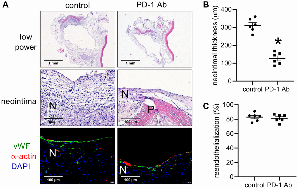 Intraperitoneal (IP) injection of PD-1 decreases neointimal thickness after patch venoplasty in rats. (A) Representative image of the patch stained with H&E at day 14; first row: a low-power image of H&E staining; second row: a high-power image of H&E staining showing the neointima; third row: merged immunofluorescence image of vWF (green) and α-actin (red) and DAPI (blue) staining showing the neointima. PD-1 Ab (IP injection of humanized PD-1 antibody group); P, patch; N, neointima; n = 6. (B) Bar graph showing neointimal thickness; *p t-test; n = 6. (C) Bar graph showing neointimal reendothelialization; p = 0.6104, t-test; n = 6.