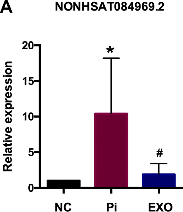 (A) NONHSAT 084969.2 expression in Pi and Pi + Exo group.