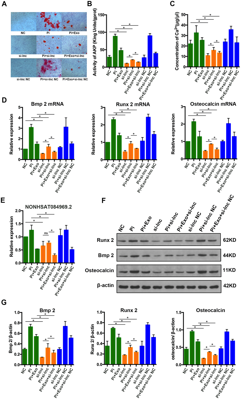 (A) Alizarin Red S staining. (B, C) Determination of AKP activity and Ca2+ concentration in each group. (D) RT-qPCR analysis of mRNAs associated with osteogenic transdifferentiation. (E) RT-qPCR analysis of NONHSAT 084969.2. (F, G) Western blot analysis of protein expression. *P