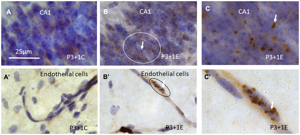 γH2AX immunostaining counterstained with hematoxylin shows that γH2AX foci are almost undetectable in the stratum pyramidale of CA1 area of the hippocampus (A) of P4 mice without irradiation. Irradiation with 5Gy induced obvious γH2AX foci (arrows) in the stratum pyramidale of CA1 area (B, C is magnified from the ellipse in B) at 1 day after irradiation at P3. Similarly, γH2AX foci are undetectable in the blood vessel of the hippocampus (A’) of P4 mice without irradiation. Irradiation induced obvious γH2AX foci (arrows) in the hippocampal blood vessel (B’, C’ is magnified from the ellipse in B’) at 1 day after irradiation at P3. Scan bar=25μm in (A) applies to (B–C) (A’–C’).