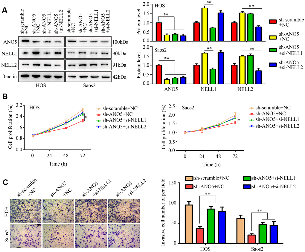 NELL1 and NELL2 knockdown suppressed ANO5-induced inhibition of proliferation and invasion. (A) Western blot was used to detect the effects of NELL1 and NELL2 inhibition on expression of ANO5, NELL1, and NELL2 in ANO5 knockdown cells. (B) CCK-8 was used to detect the effects of NELL1 and NELL2 knockdown on ANO5 suppression-induced inhibition of cell proliferation. (C) A transwell assay was used to detect the effects of NELL1 and NELL2 knockdown on ANO5 suppression-induced inhibition of cell invasion. *, PP