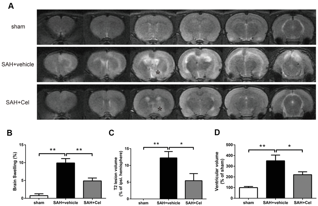 Celastrol attenuated brain swelling, reduced T2 lesion volume and ventricular volume after SAH. (A) Representative T2-weighted MRI images (3.0T) of the brains of sham, SAH + vehicle, and SAH + Cel group. (B) Brain swelling was calculated as: ((volume of ipsilateral hemisphere - volume of contralateral hemisphere)/volume of contralateral hemisphere) × 100%. (C) T2 lesion volume was presented as the volume ratio to the ipsilateral hemisphere. (D) Ventricular volume was calculated as Σ(An + An + 1) × d / 2, and was presented as the volume ratio to the average volume of the sham group. Data were presented as mean±SEM. n = 6. *P P 