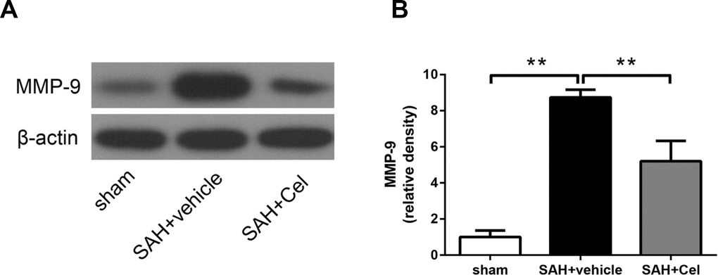 Effect of celastrol treatment on MMP-9 expression at 72 h after SAH induction. (A) Representative WB showing levels of MMP-9 in the ipsilateral cortex of each group at 72 h after SAH induction. (B) Quantifications of band densities of MMP-9. The densities of the protein bands were analyzed and normalized to β-actin, and compared to the mean value of the sham group. Data were presented as mean±SEM. n = 6. **P 