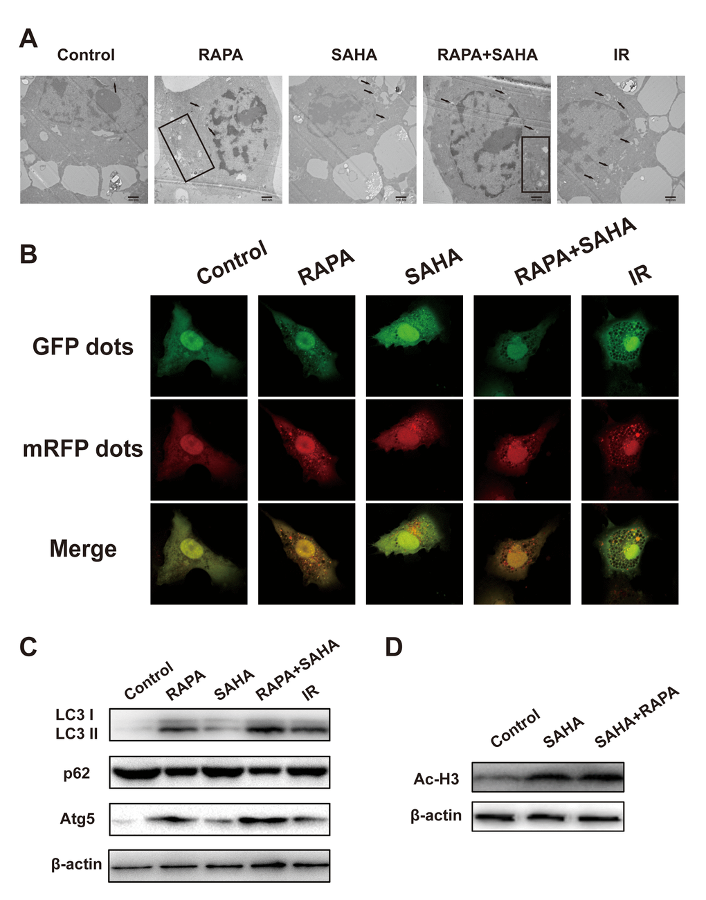 Effects of combination treatment with RAPA and SAHA on autophagy and acetylation in NSCLC cells. (A–C) RAPA, SAHA, and IR induce cellular autophagy. A549 cells were treated with RAPA (100nmol/L) or/and SAHA (2.5μmol/L) for 24h or were exposed to IR (4Gy) and were tested after 4h. (A) The ultrastructures of autophagosomes in A549 cells were observed under a transmission electron microscope (TEM). Black arrows and rectangles indicate intracellular autophagosomes. (B) The distribution of LC3 dots in A549 cells was observed by using an immunofluorescence confocal microscope. Quantitative data were calculating the number of LC3 dots per cell. *p#pC) The level of autophagy-related protein (LC3 I/II, p62, Atg5) was determined by western blot analysis. (D) SAHA induces acetylation of A549 cells. A549 cells were treated with SAHA (2.5μmol/L) and/or RAPA (100nmol/L) for 24h. The level of acetylation of histone H3 was determined by western blot analysis.