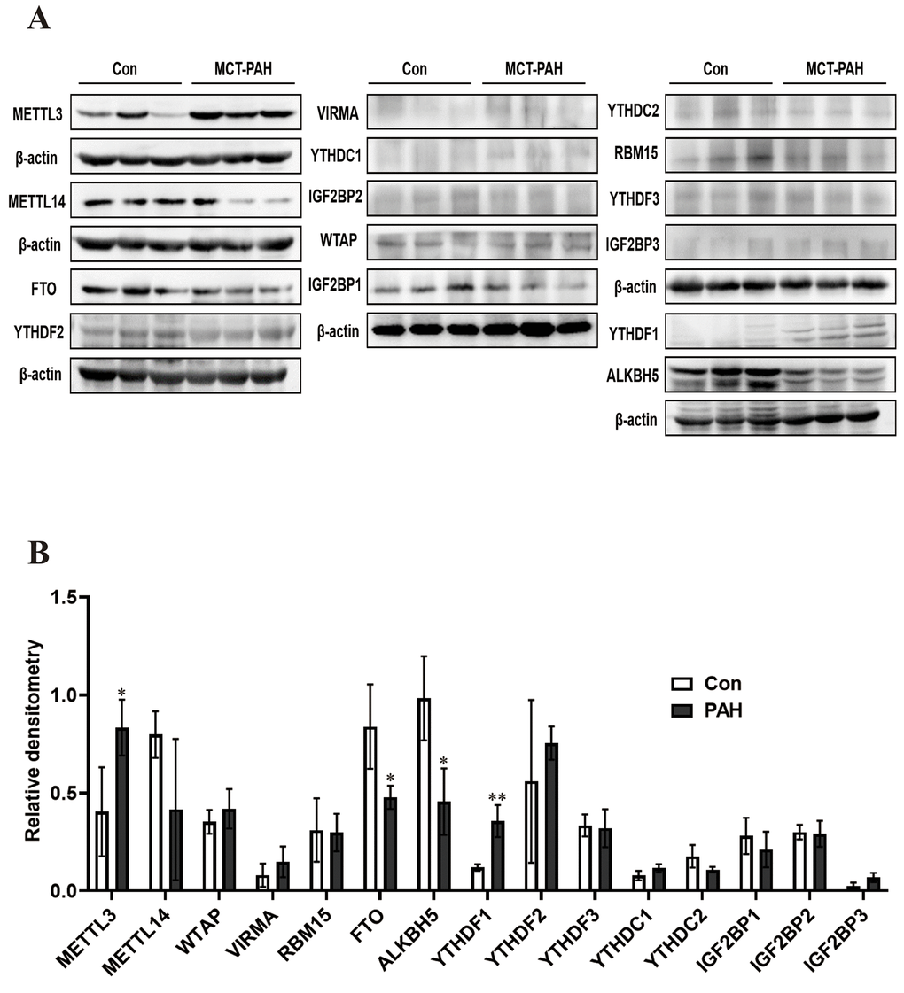 Western blot was used to detect the expression of methylated protein in rat lung tissue. (A) Western blot image of methylated modified enzyme. (B) Statistical graph of the expression of methylated modifying enzymes. *P P 