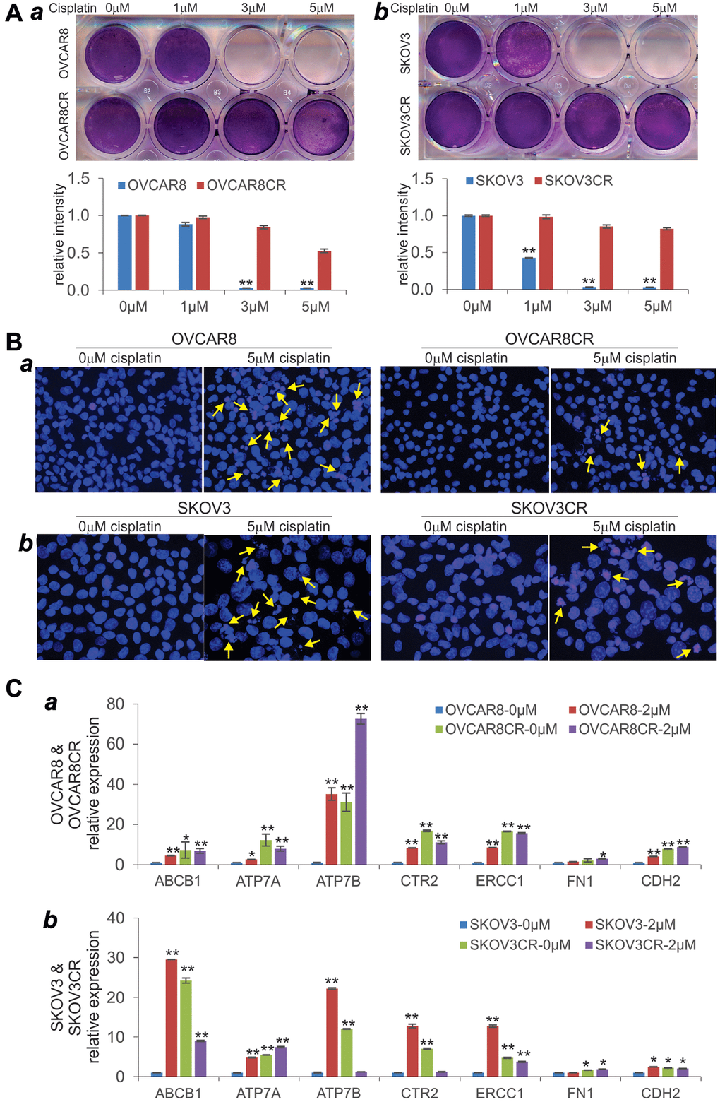 Characterization of human cisplatin-resistant (CR) ovarian cancer cell lines. (A) Crystal violet cell viability assay. Subconfluent two CR lines OVCAR8CR (a) and SKOV3CR (b), and the respective parental counterparts OVCAR8 (a) and SKOV3 (b) were treated with the indicated concentrations of cisplatin. At 72 h post treatment, cells were fixed and subjected to crystal violet staining. Representative results are shown. The stained cells were dissolved and measured quantitatively for optical absorbance. **p B) Cell apoptosis assay. Subconfluent OVCAR8 (a), OVCAR8CR (b), SKOV3CR (c) and SKOV3CR (d) were treated with 0 or 5 μM cisplatin. At 72 h post treatment, cells were collected, fixed and stained with Hoechst33258 and examined under a fluorescence microscope. Representative images are shown. Representative apoptotic cells are indicated by arrows. (C) Expression of the chemoresistance-associated genes in the two cisplatin-resistant human ovarian cancer lines. Subconfluent two CR lines OVCAR8CR (a) and SKOV3CR (b), and the respective parental counterparts OVCAR8 (a) and SKOV3 (b) were treated with 0 or 2 μM cisplatin. At 48 h after treatment, total RNA was isolated and subjected to qPCR analysis of the indicated genes. GAPDH was used as a reference gene. All assays were done in triplicate. *p **p 