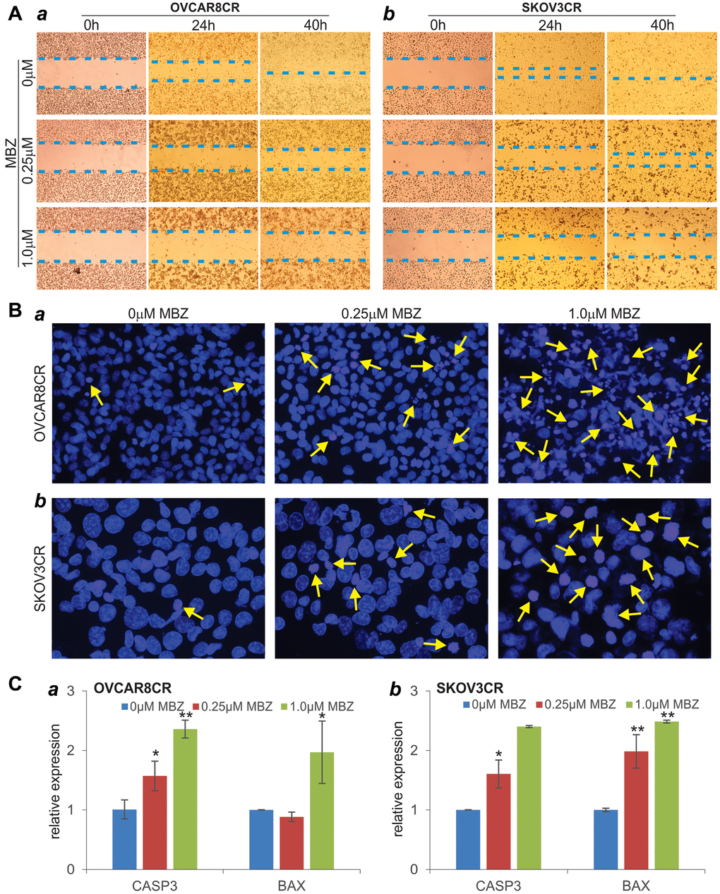 MBZ effectively inhibits cell wound healing/migration and induces apoptosis in the human CR ovarian cancer cells. (A) Cell wounding/migration assay. Freshly subconfluent OVCAR8CR (a) and SKOV3CR (b) cells were wounded with micro-pipette tips and treated with the indicated concentrations of MBZ. The wounding gaps were recorded at 0 h, 24 h and 40 h after MBZ treatment. Each assay condition was done in triplicate. Representative results are shown (B) Cell apoptosis assay. Subconfluent OVCAR8CR (a) and SKOV3CR (b) cells were treated with the indicated concentrations of MBZ. At 72 h after treatment, cells were collected, fixed and stained with Hoechst 33258 and examined under a fluorescence microscope. Representative images are shown. Representative apoptotic cells are indicated by arrows. (C) The expression of apoptosis-inducing genes. Subconfluent OVCAR8CR (a) and SKOV3CR (b) cells were treated with the indicated concentrations of MBZ for 48 h. Total RNA was isolated and subjected to qPCR analysis of the expression of CASP3 and BAX. GAPDH was used as the reference gene. All assays were done in triplicate. *p **p 