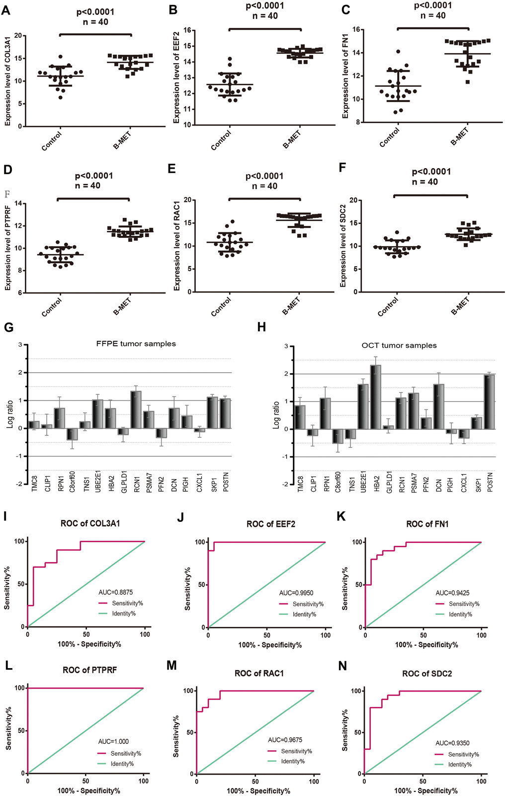 Comparable evaluation of the expression patterns and ROC curves of six differentially expressed hub genes between PCa and controls. Expression levels of COL3A1 (A), EEF2 (B), FN1 (C), PTPRF (D), RAC1 (E), and SDC2 (F). Detection of the expression values of the randomly selected DGEs in FFPE (G) and OCT (H) samples compared with the microarray data respectively. ROC curves of COL3A1 (I), EEF2 (J), FN1 (K), PTPRF (L), RAC1 (M), and SDC2 (N). (Means ± SEM FFPE n=5; OCT n=4).