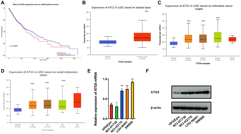 The expression and prognosis of ATG5 in LUSC. (A) Survival curves of ATG5 expression for prognosis in the TCGA-LUSC dataset. Red represents high expression group and blue was for low expression; (B) Compare with normal group(blue), the expression of ATG5 was high in tumor samples (red) (C and D) Box plots of ATG5 expression in different clinical stages, N stages of LUSC; (E and F) mRNA and protein expressions of ATG5 in HPAEpic and LUSC cell lines (NCI-H1730, NCI-H2170, LOU-NH91 and SW900) All the P values were compared with the control *P **P ***P 